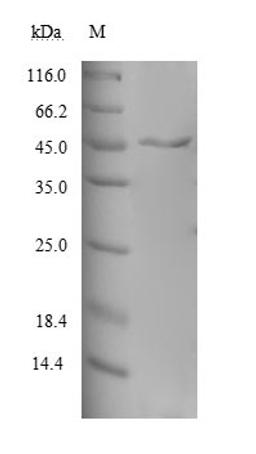 (Tris-Glycine gel) Discontinuous SDS-PAGE (reduced) with 5% enrichment gel and 15% separation gel.