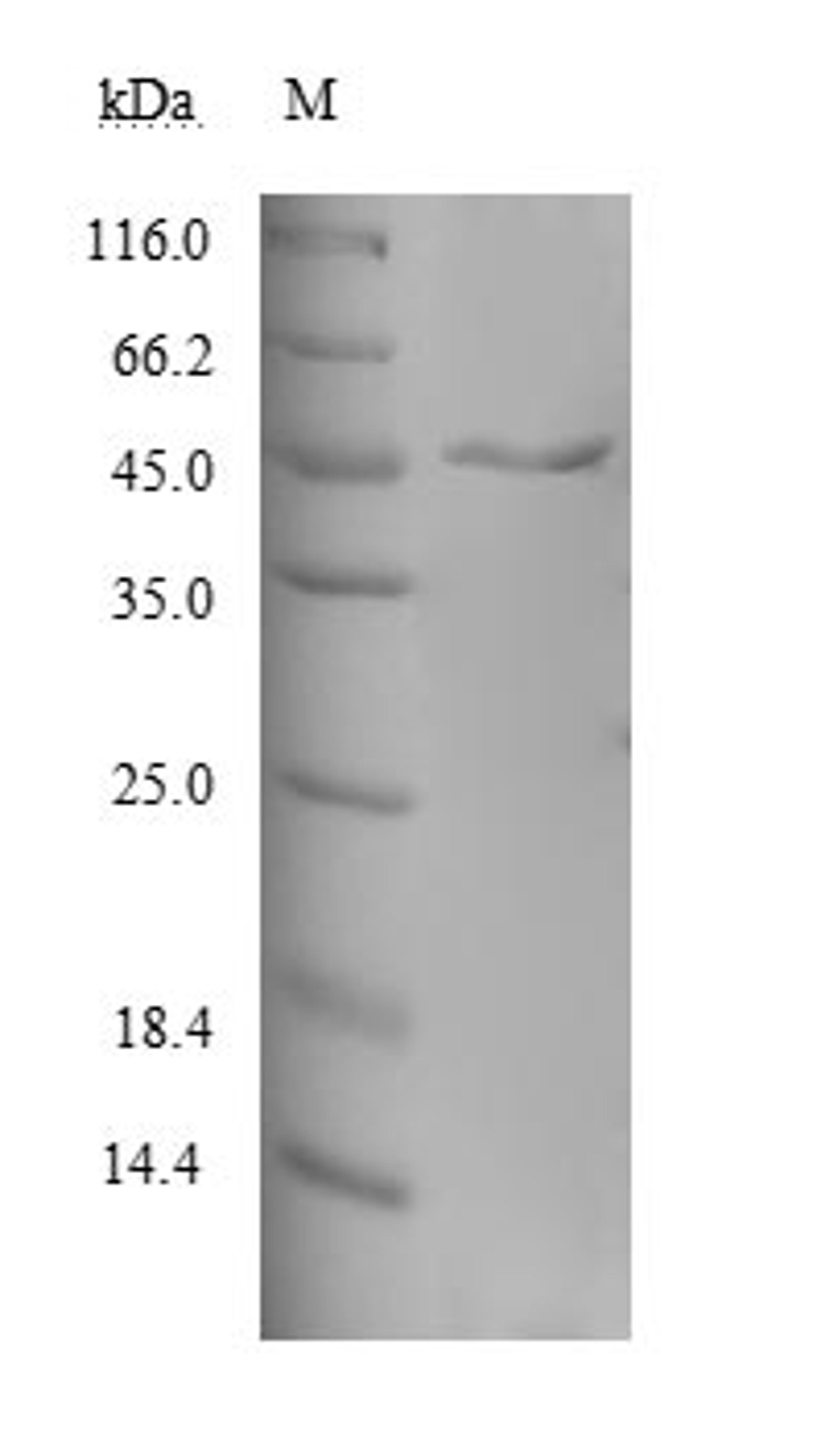 (Tris-Glycine gel) Discontinuous SDS-PAGE (reduced) with 5% enrichment gel and 15% separation gel.