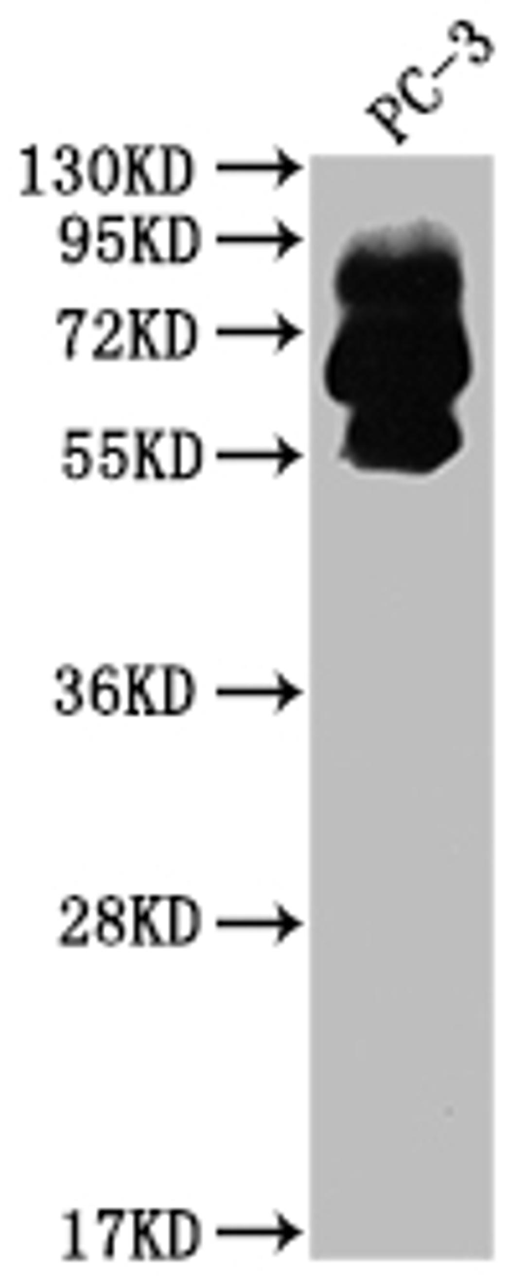 Western Blot. Positive WB detected in: PC-3 whole cell lysate. All lanes: PCSK9 antibody at 1:2000. Secondary. Goat polyclonal to rabbit IgG at 1/50000 dilution. Predicted band size: 75, 21 kDa. Observed band size: 60, 75 kDa. 