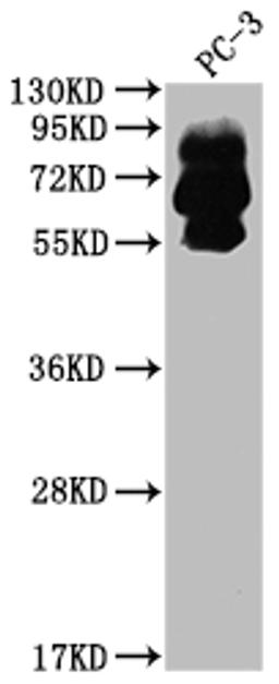 Western Blot. Positive WB detected in: PC-3 whole cell lysate. All lanes: PCSK9 antibody at 1:2000. Secondary. Goat polyclonal to rabbit IgG at 1/50000 dilution. Predicted band size: 75, 21 kDa. Observed band size: 60, 75 kDa. 
