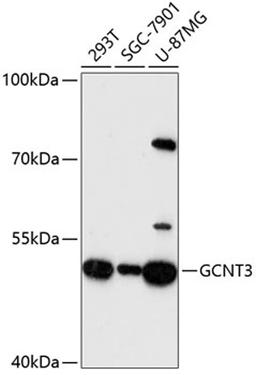 Western blot - GCNT3 antibody (A13209)