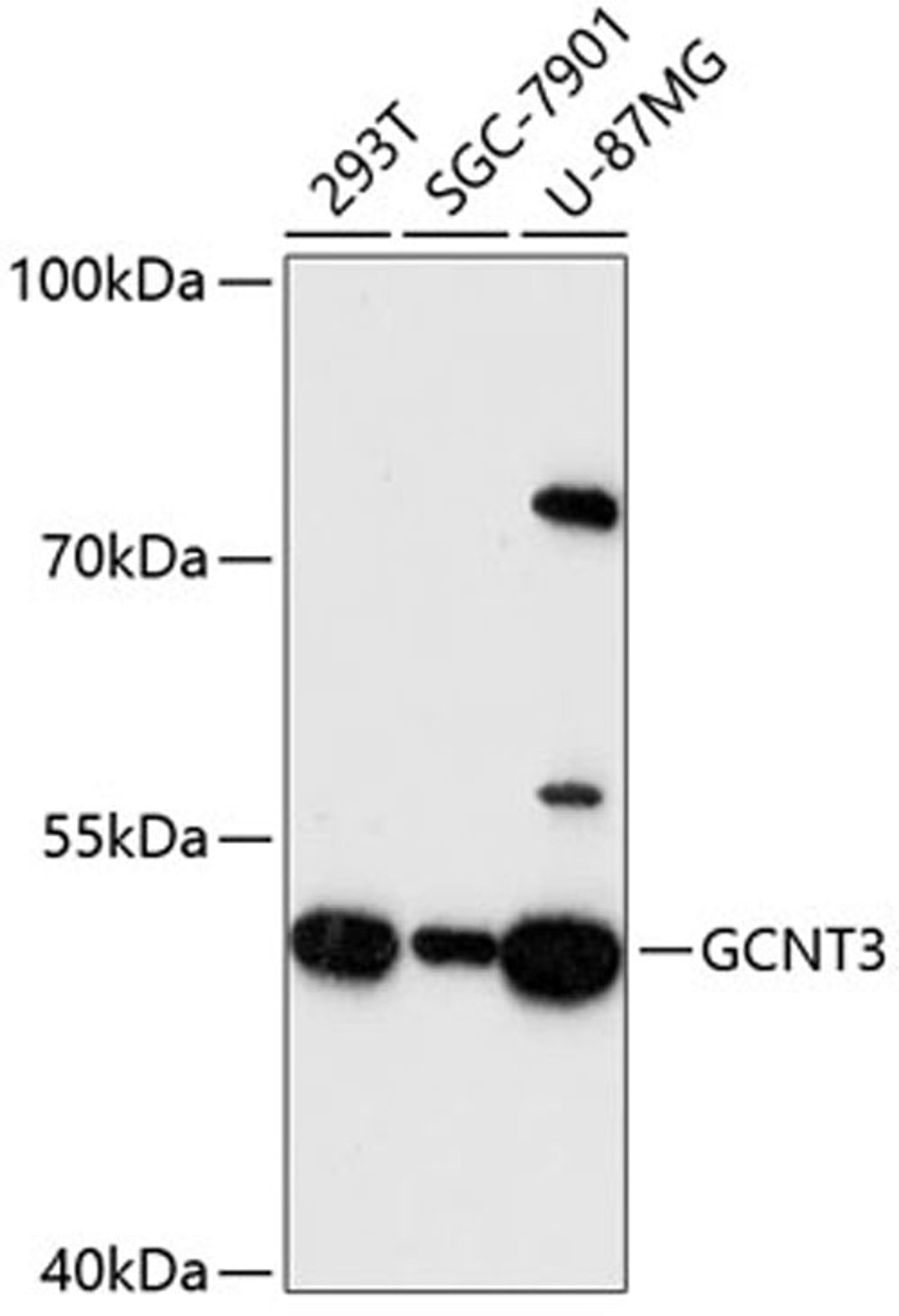 Western blot - GCNT3 antibody (A13209)