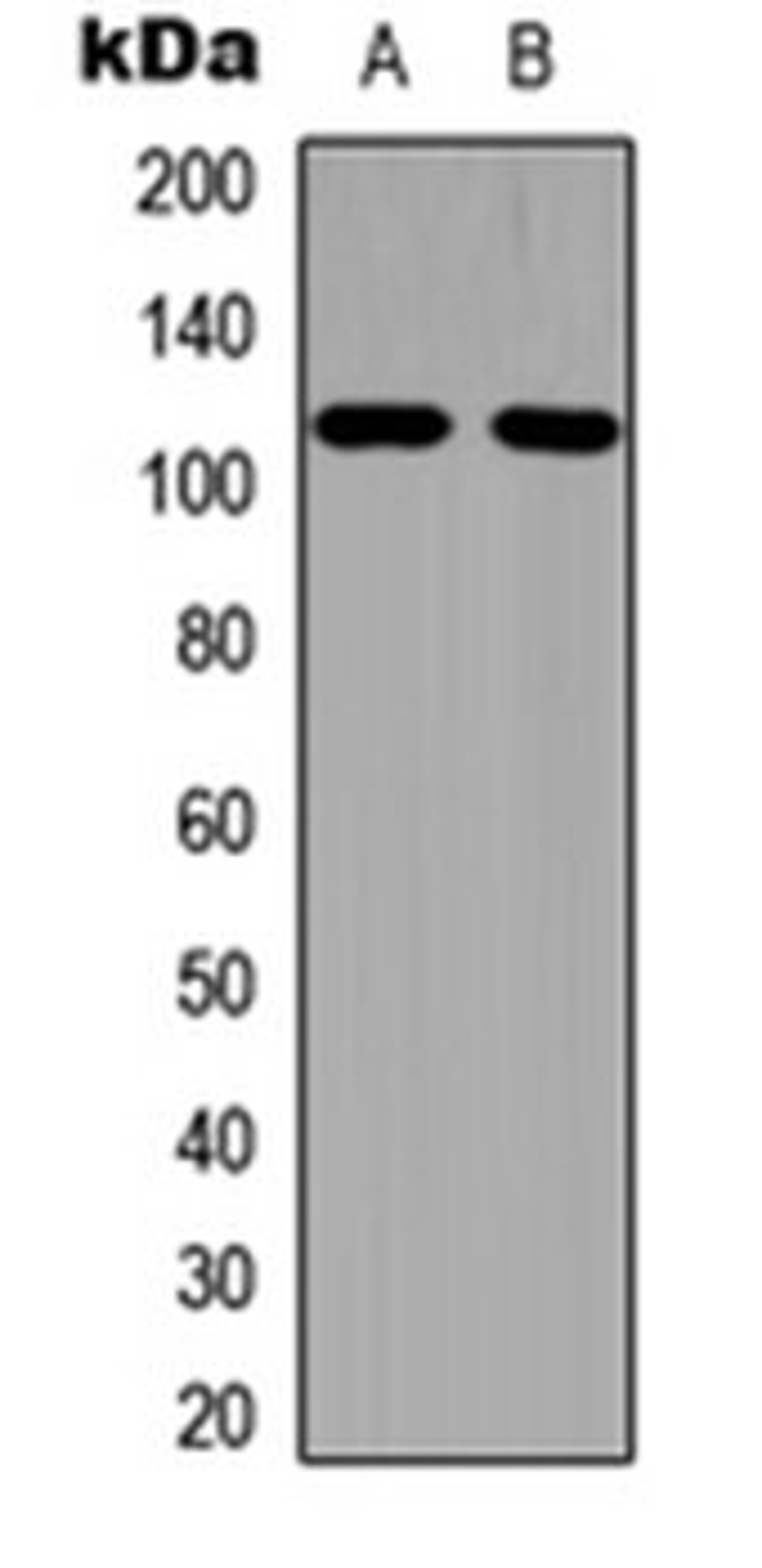 Western blot analysis of A549 (Lane 1), PC12 (Lane 2) whole cell lysates using EPHA1 (phospho-Y605) antibody