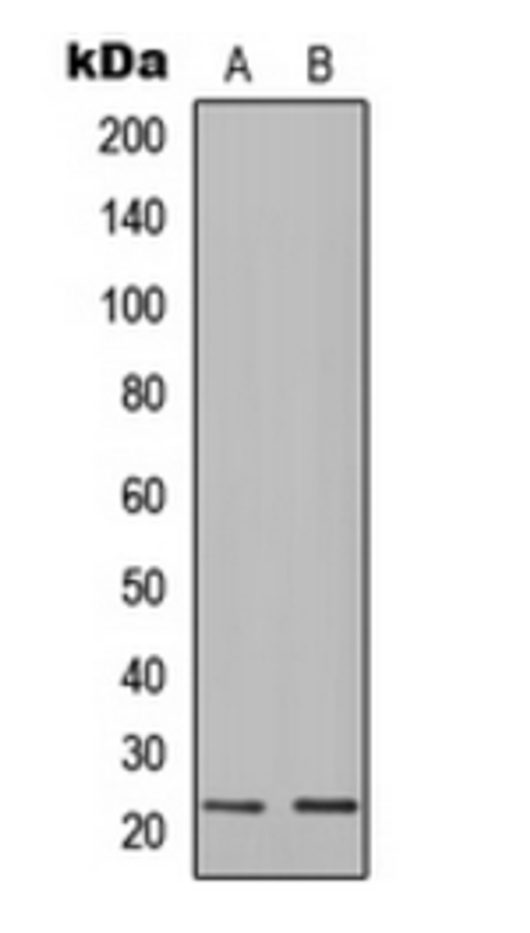 Western blot analysis of K562 (Lane 1), human spleen (Lane 2) whole cell lysates using IGLC1 antibody