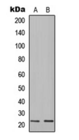 Western blot analysis of K562 (Lane 1), human spleen (Lane 2) whole cell lysates using IGLC1 antibody