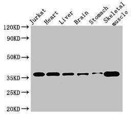 Western Blot. Positive WB detected in: Jurkat whole cell lysate, Mouse heart tissue, Mouse brain tissue, Mouse kidney tissue, Mouse stomach tissue, Mouse skeletal muscle tissue. All lanes: USE1 antibody at 2.8ug/ml. Secondary. Goat polyclonal to rabbit IgG at 1/50000 dilution. Predicted band size: 30, 17, 16 kDa. Observed band size: 36 kDa. 