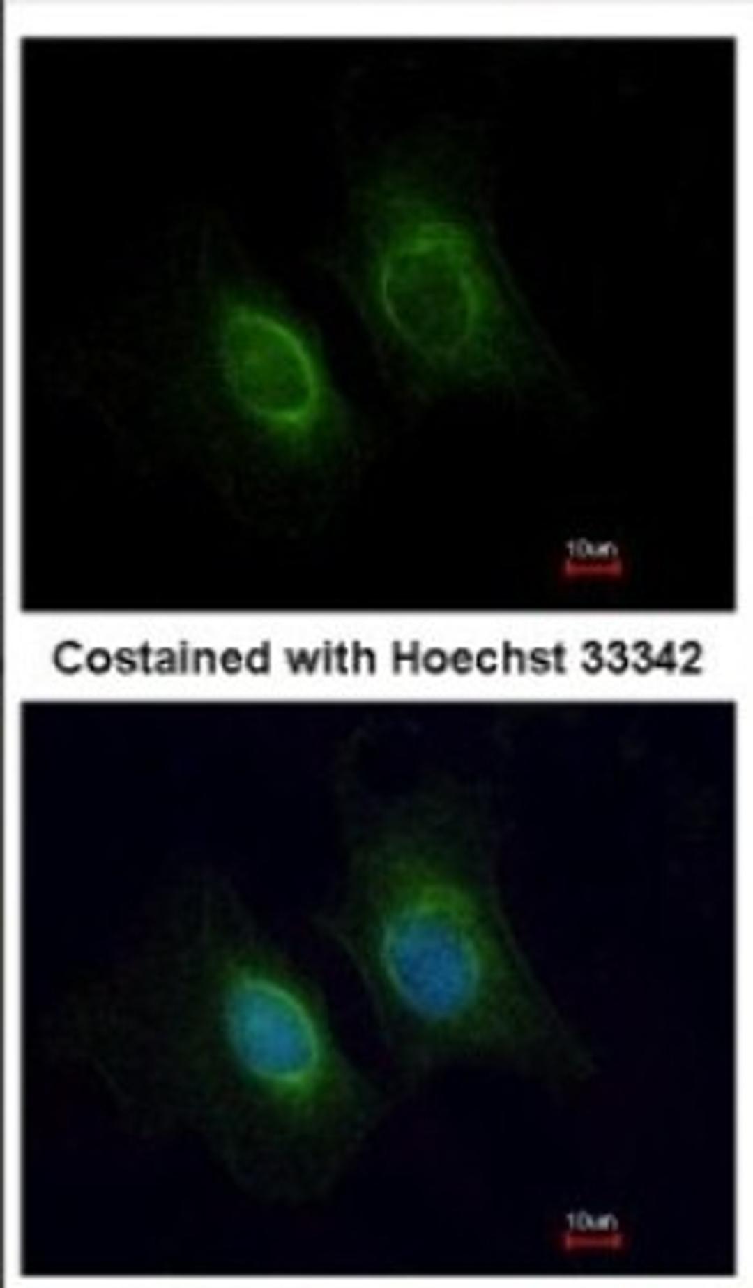 Immunocytochemistry/Immunofluorescence: Keratin 36 Antibody [NBP2-17038] - Immunofluorescence analysis of methanol-fixed HeLa, using antibody at 1:200 dilution.