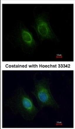 Immunocytochemistry/Immunofluorescence: Keratin 36 Antibody [NBP2-17038] - Immunofluorescence analysis of methanol-fixed HeLa, using antibody at 1:200 dilution.