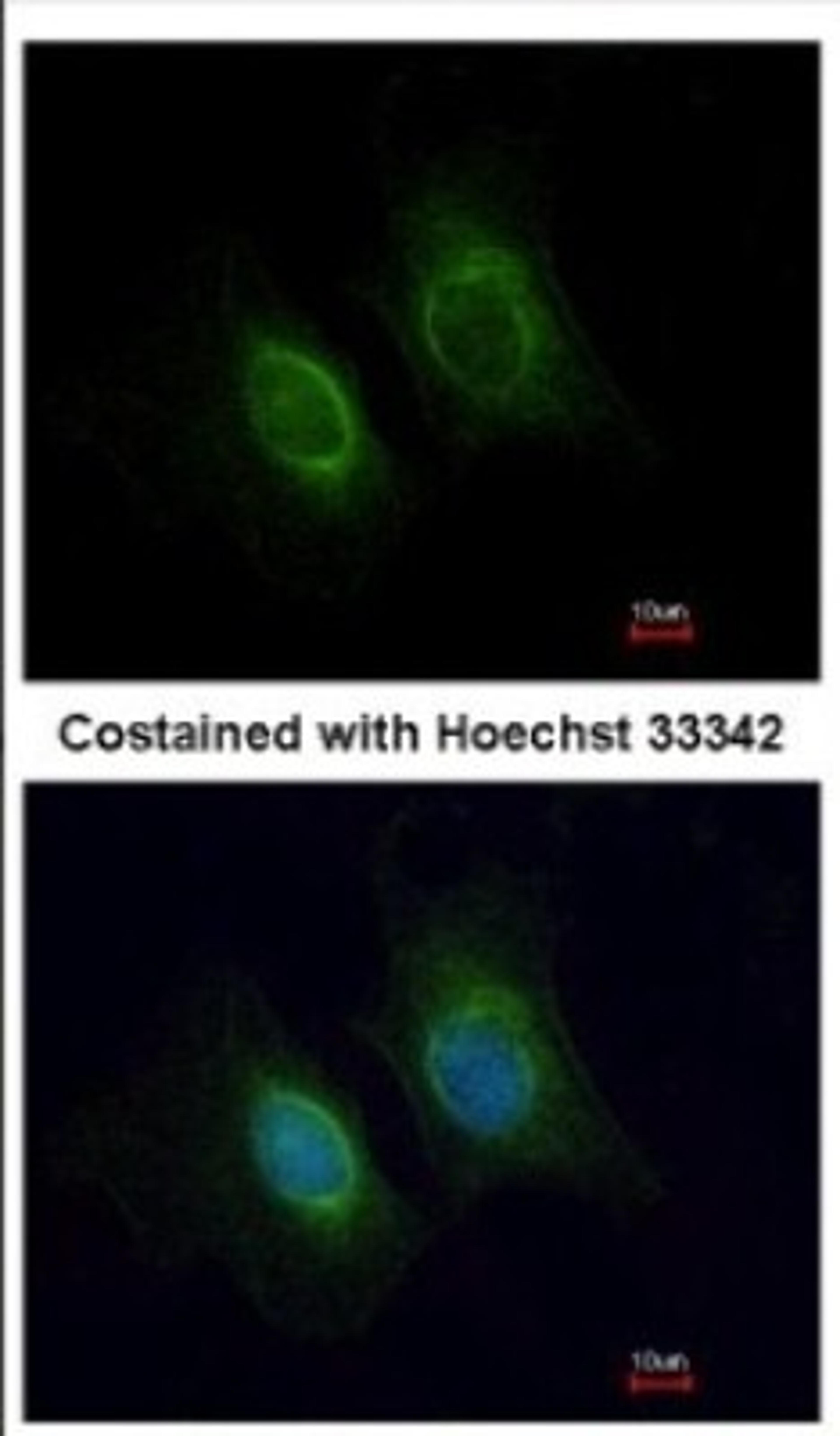 Immunocytochemistry/Immunofluorescence: Keratin 36 Antibody [NBP2-17038] - Immunofluorescence analysis of methanol-fixed HeLa, using antibody at 1:200 dilution.