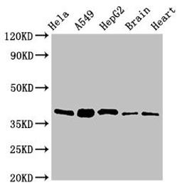 Western Blot. Positive WB detected in: Hela whole cell lysate, A549 whole cell lysate, HepG2 whole cell lysate, Mouse brain tissue, Rat heart tissue. All lanes: RBFA antibody at 2µg/ml. Secondary. Goat polyclonal to rabbit IgG at 1/50000 dilution. Predicted band size: 39, 28 kDa. Observed band size: 39 kDa