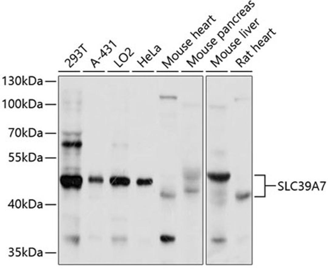 Western blot - SLC39A7 antibody (A3343)