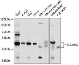 Western blot - SLC39A7 antibody (A3343)