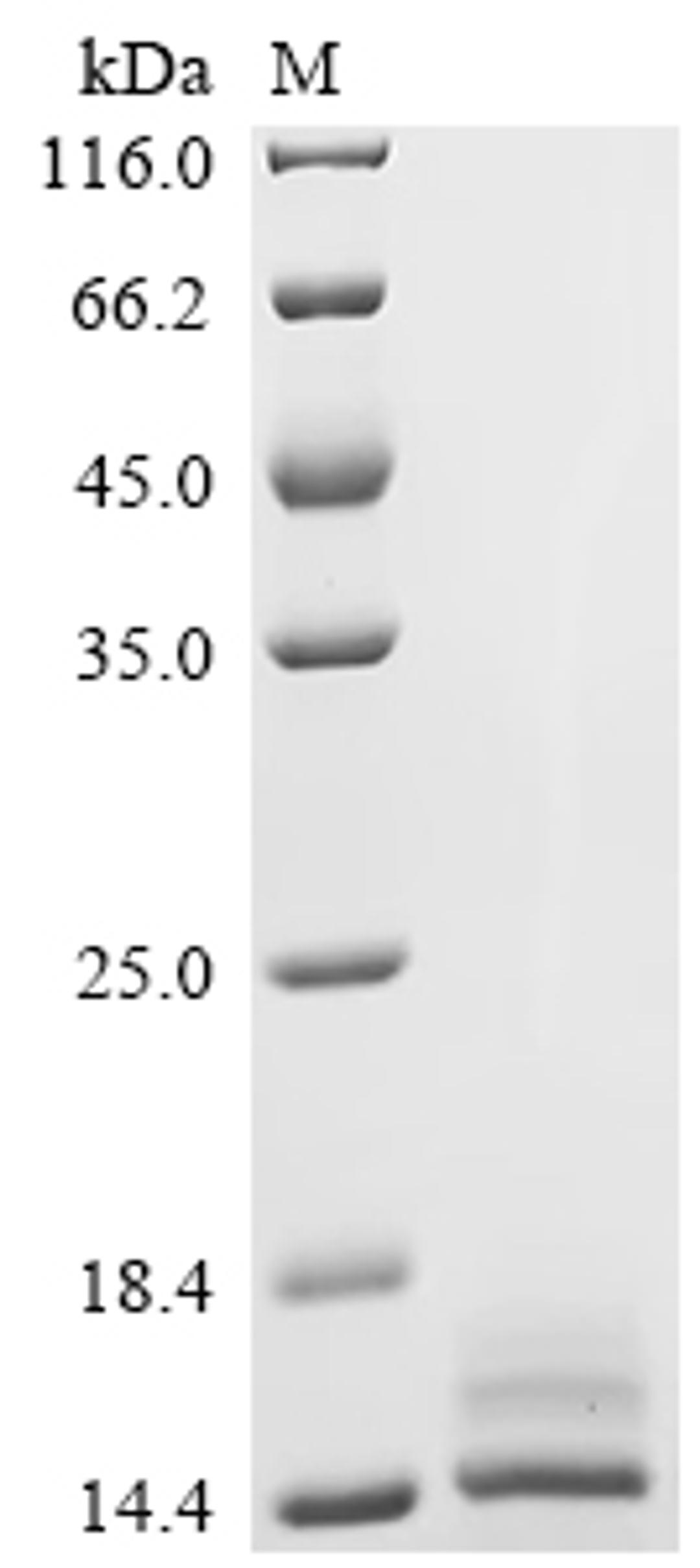 (Tris-Glycine gel) Discontinuous SDS-PAGE (reduced) with 5% enrichment gel and 15% separation gel.