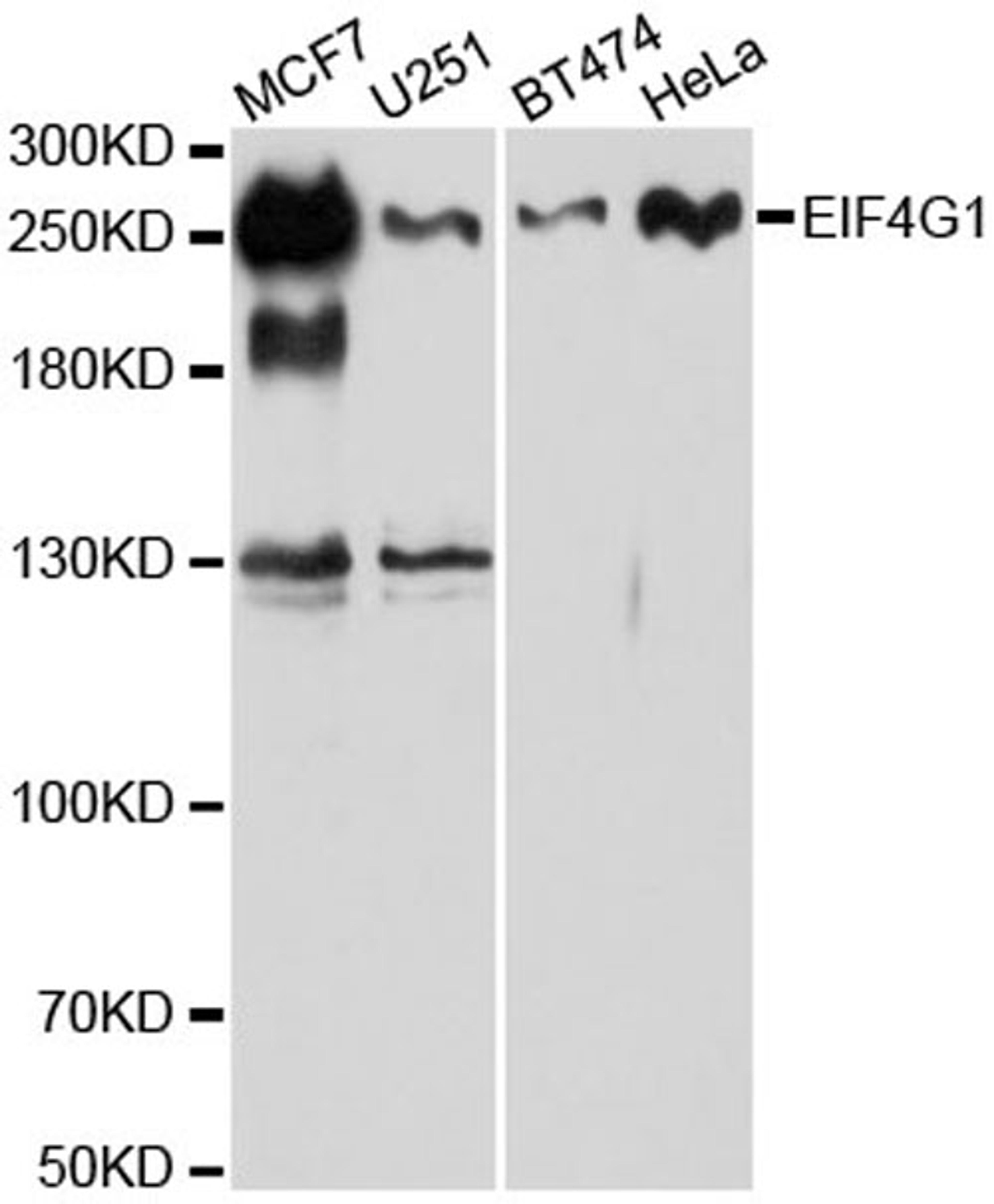 Western blot - EIF4G antibody (A6086)