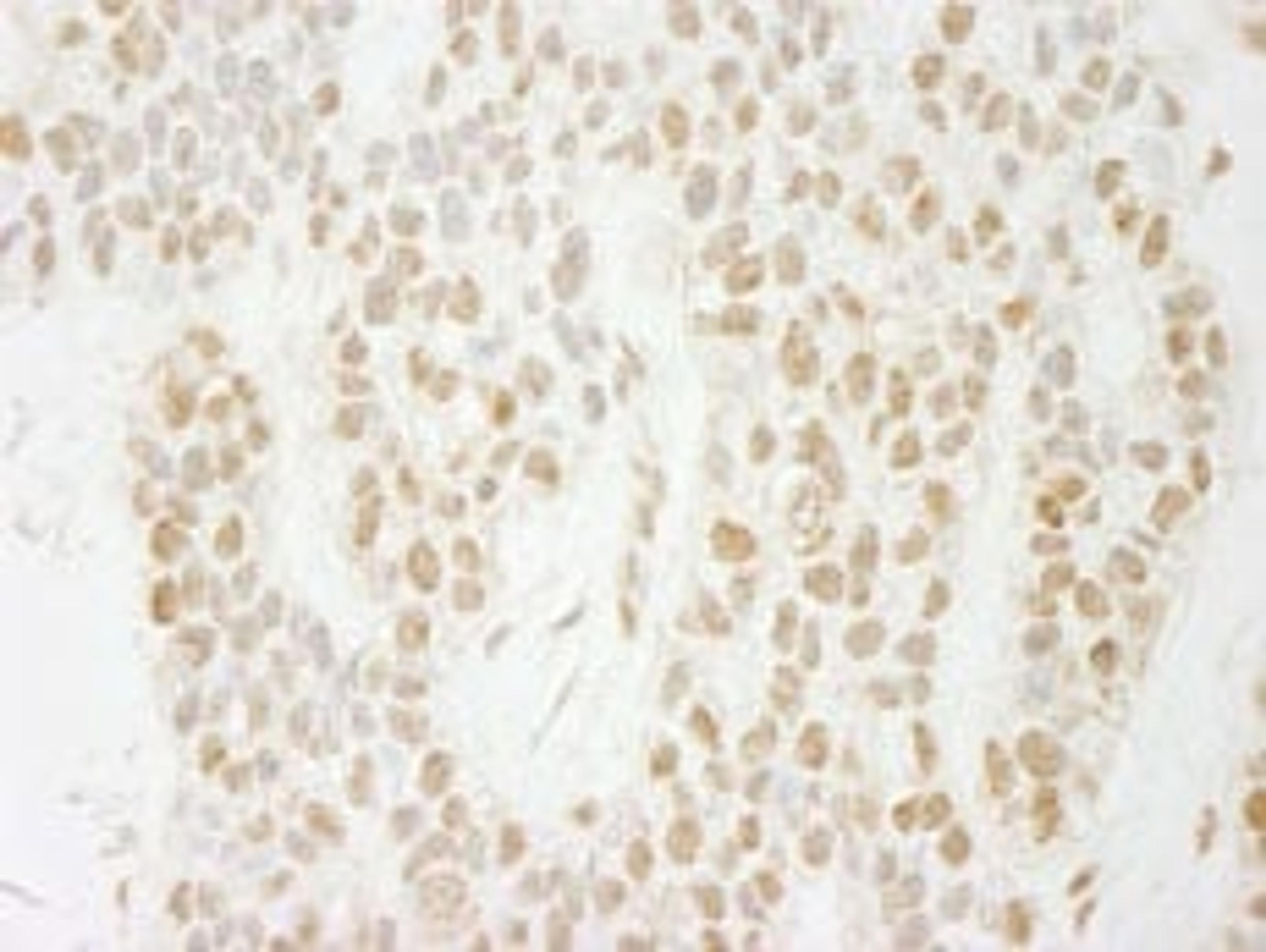 Detection of human PA1 by immunohistochemistry.