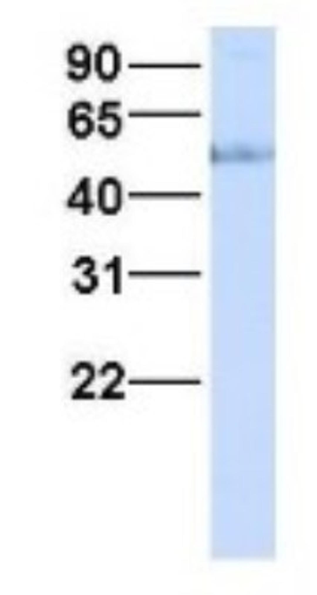 Western Blot: HHAT Antibody [NBP1-69465] - Human Fetal Liver, Antibody Dilution: 1.0 ug/ml.