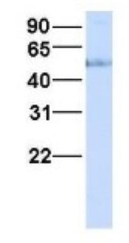 Western Blot: HHAT Antibody [NBP1-69465] - Human Fetal Liver, Antibody Dilution: 1.0 ug/ml.