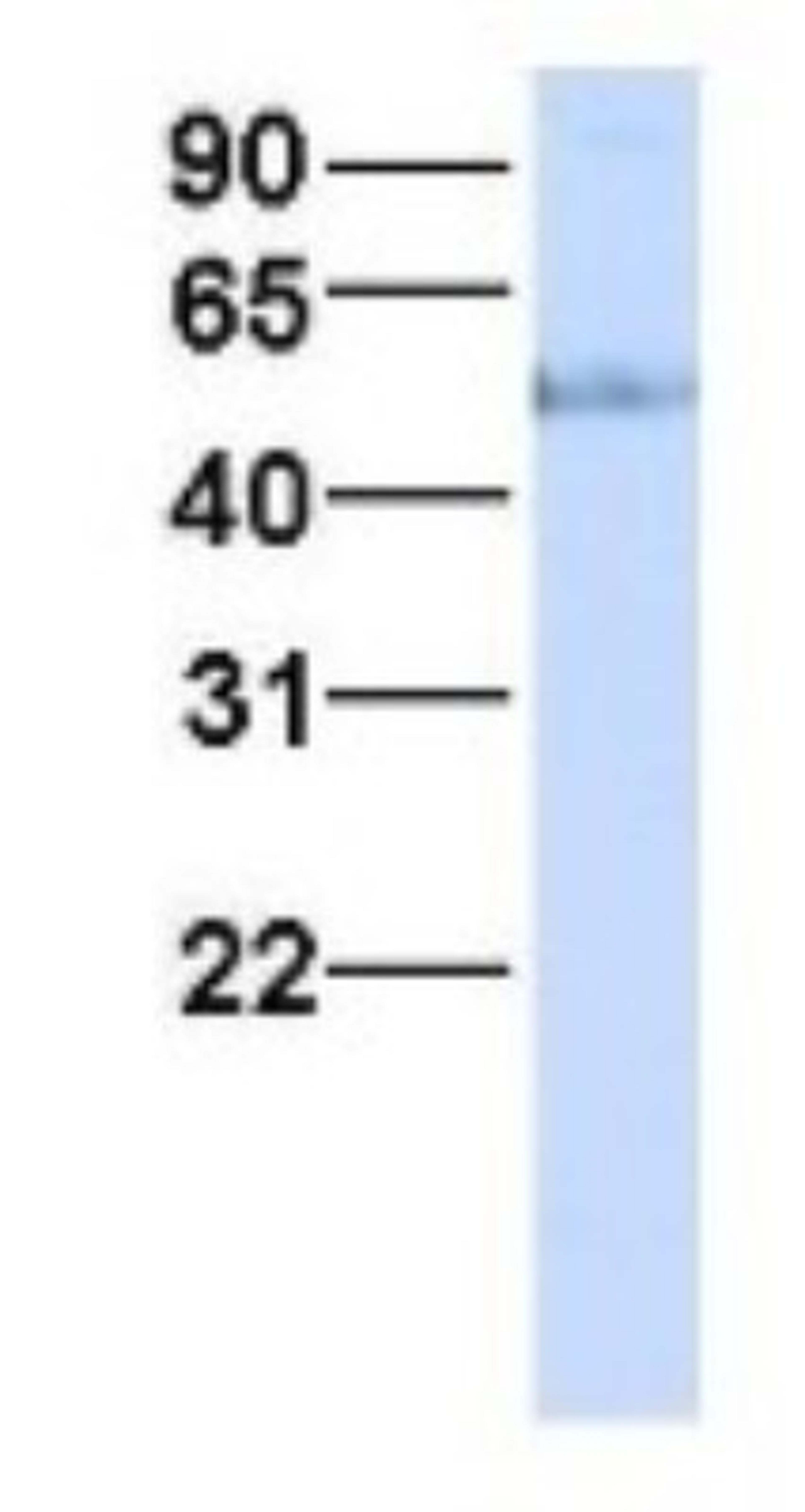 Western Blot: HHAT Antibody [NBP1-69465] - Human Fetal Liver, Antibody Dilution: 1.0 ug/ml.