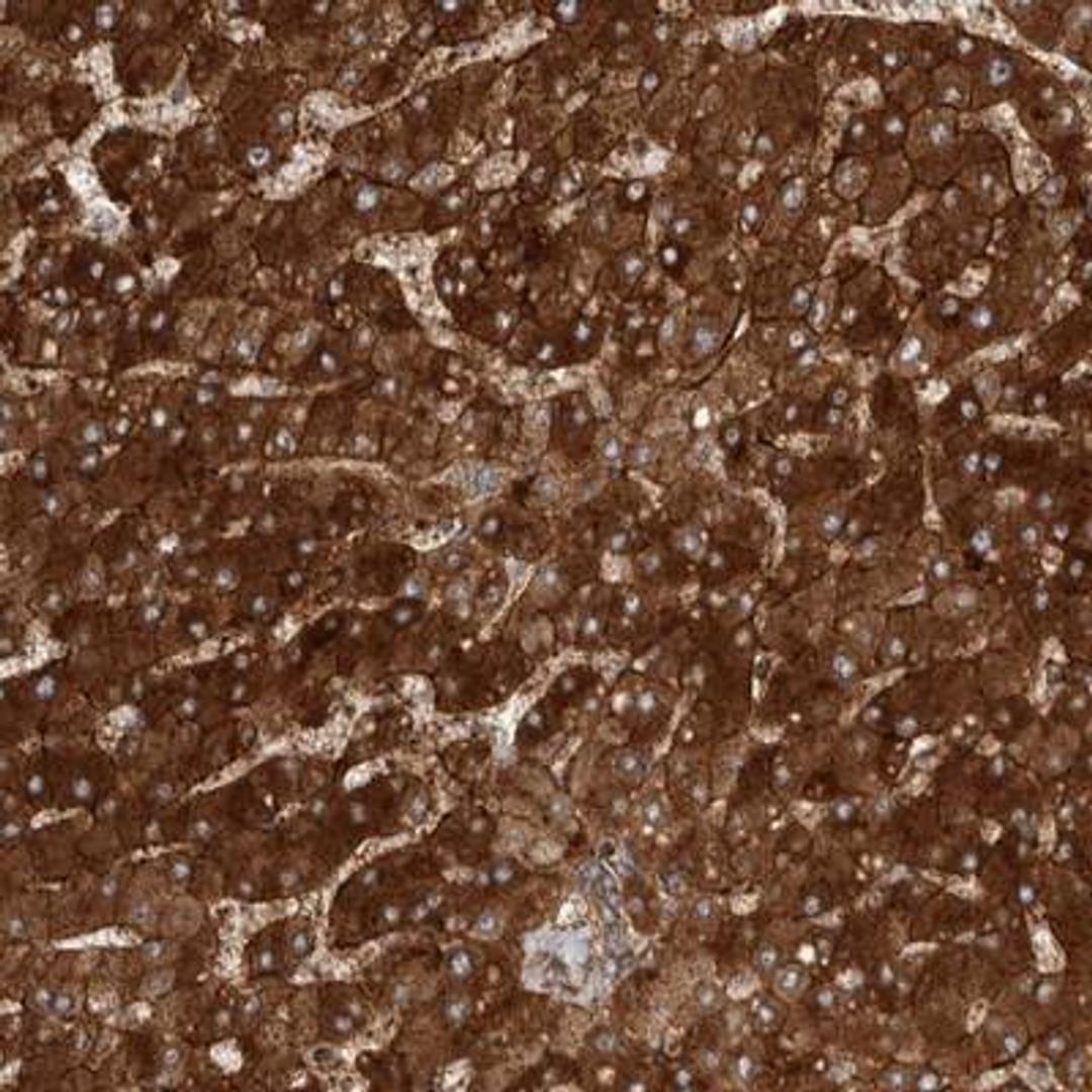 Immunohistochemistry: COLEC10 Antibody [NBP1-84442] - Staining of human liver shows strong cytoplasmic positivity in hepatocytes and bile ducts.