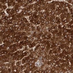 Immunohistochemistry: COLEC10 Antibody [NBP1-84442] - Staining of human liver shows strong cytoplasmic positivity in hepatocytes and bile ducts.