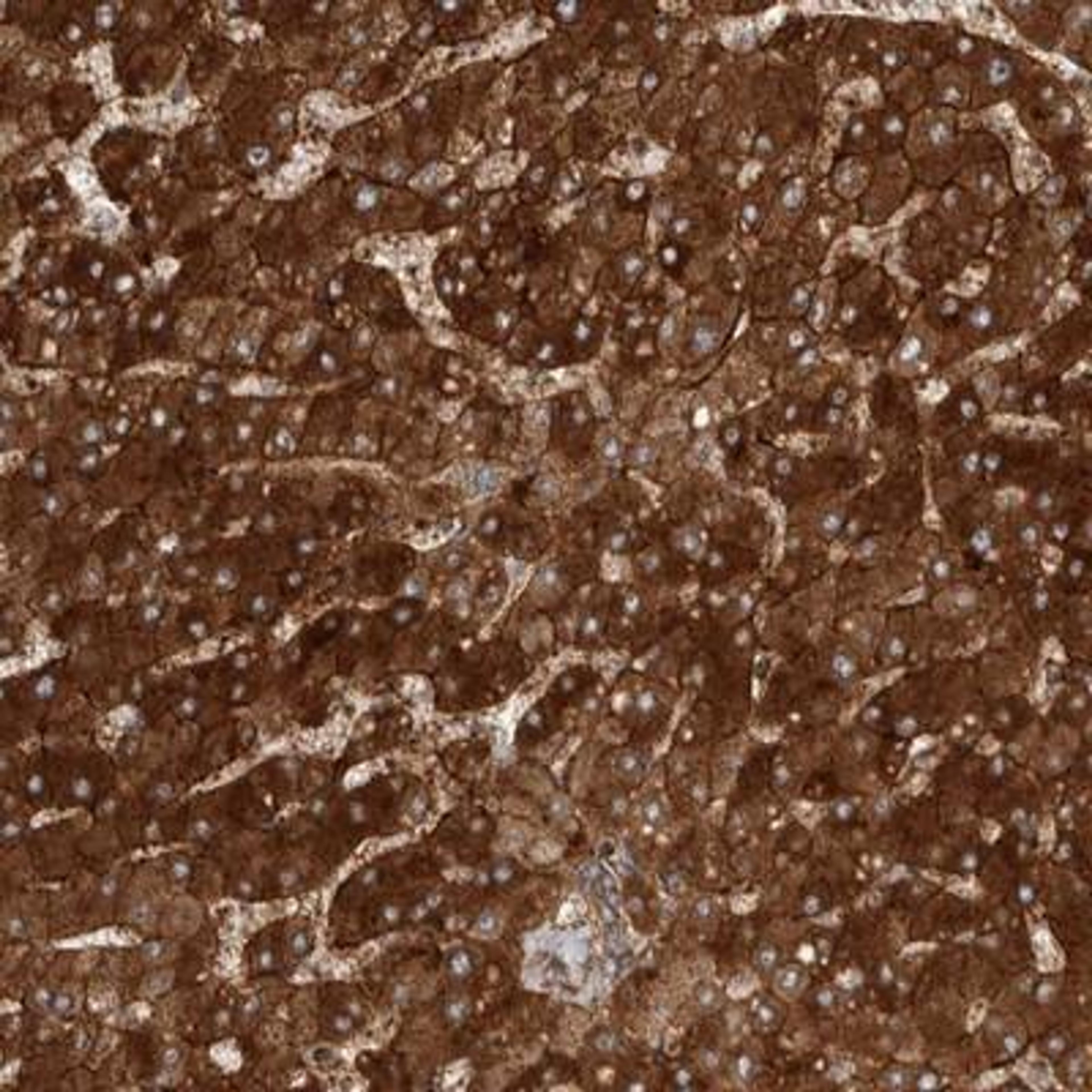 Immunohistochemistry: COLEC10 Antibody [NBP1-84442] - Staining of human liver shows strong cytoplasmic positivity in hepatocytes and bile ducts.