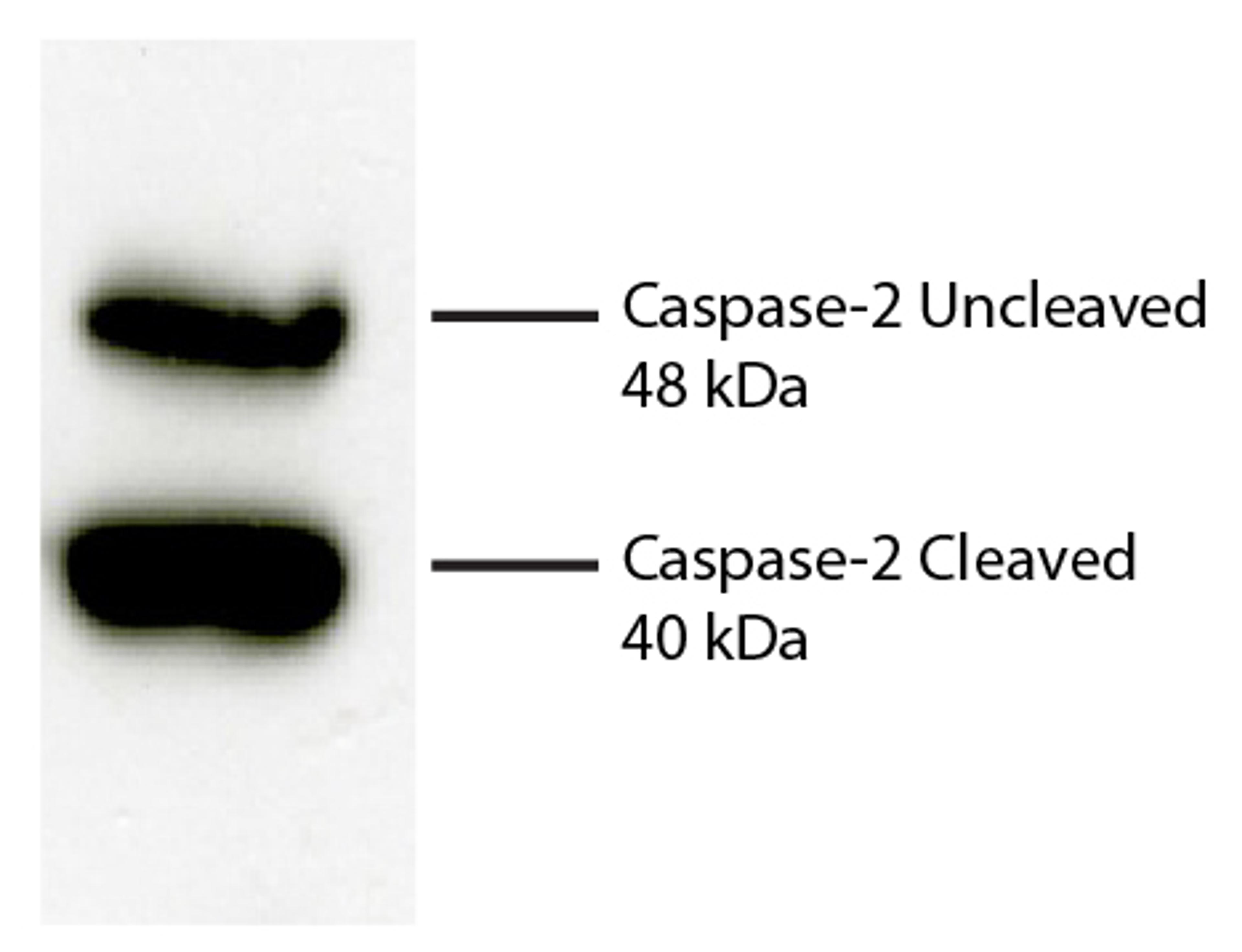 Total cell lysates from Jurkat cells were incubated with Rabbit Anti-Human DR5-UNLB , resolved by electrophoresis, transferred to PVDF membrane, and probed with Rat Anti-Human Caspase-2-UNLB (Cat. No. 99-808). Proteins were visualized using Goat Anti-Rat
