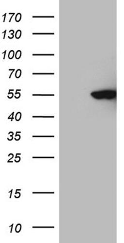 Western Blot: CDKL2 Antibody (12C2) [NBP2-46218] - Analysis of HEK293T cells were transfected with the pCMV6-ENTRY control (Left lane) or pCMV6-ENTRY CDKL2 .