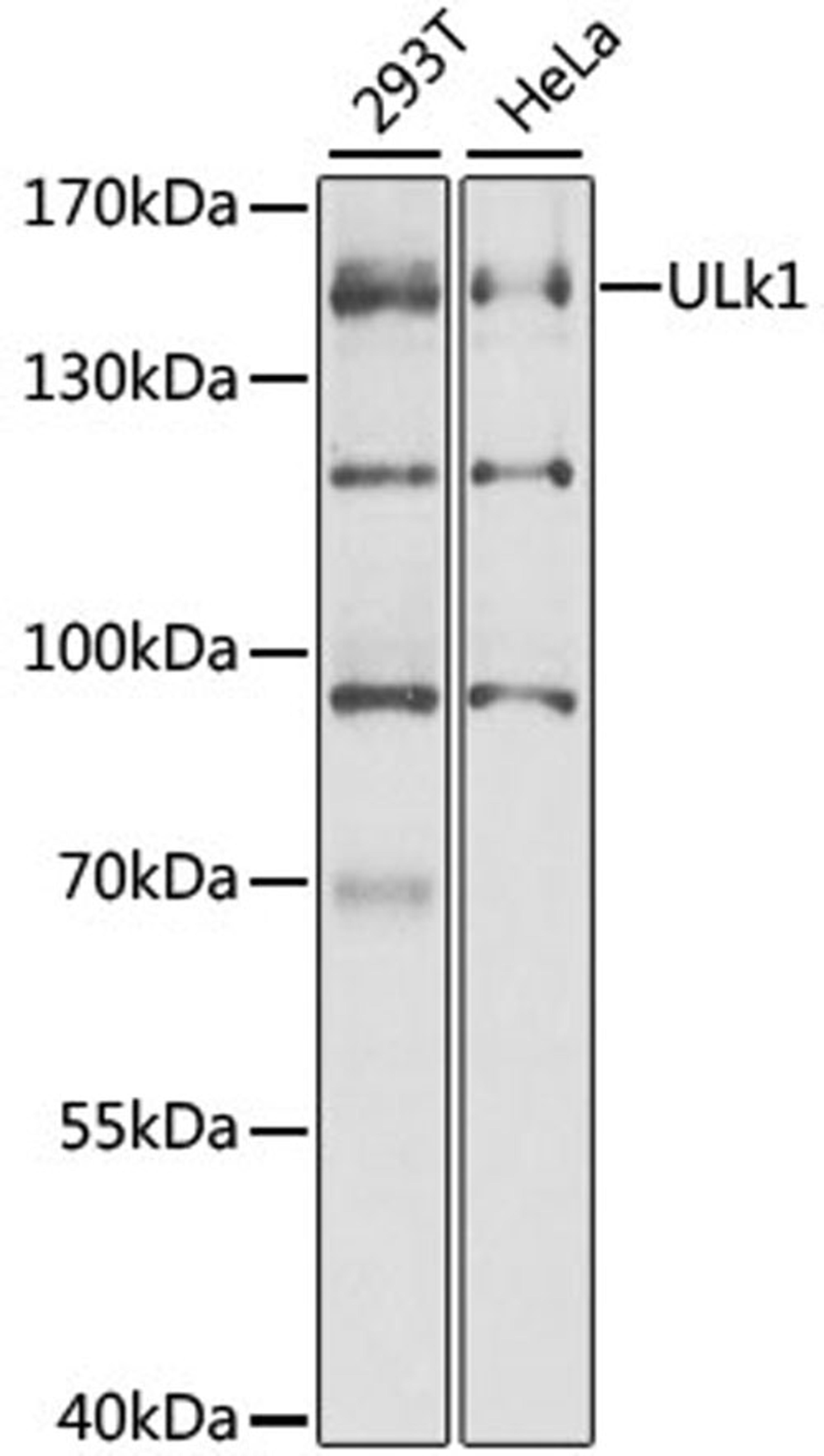 Western blot - ULK1 antibody (A8529)