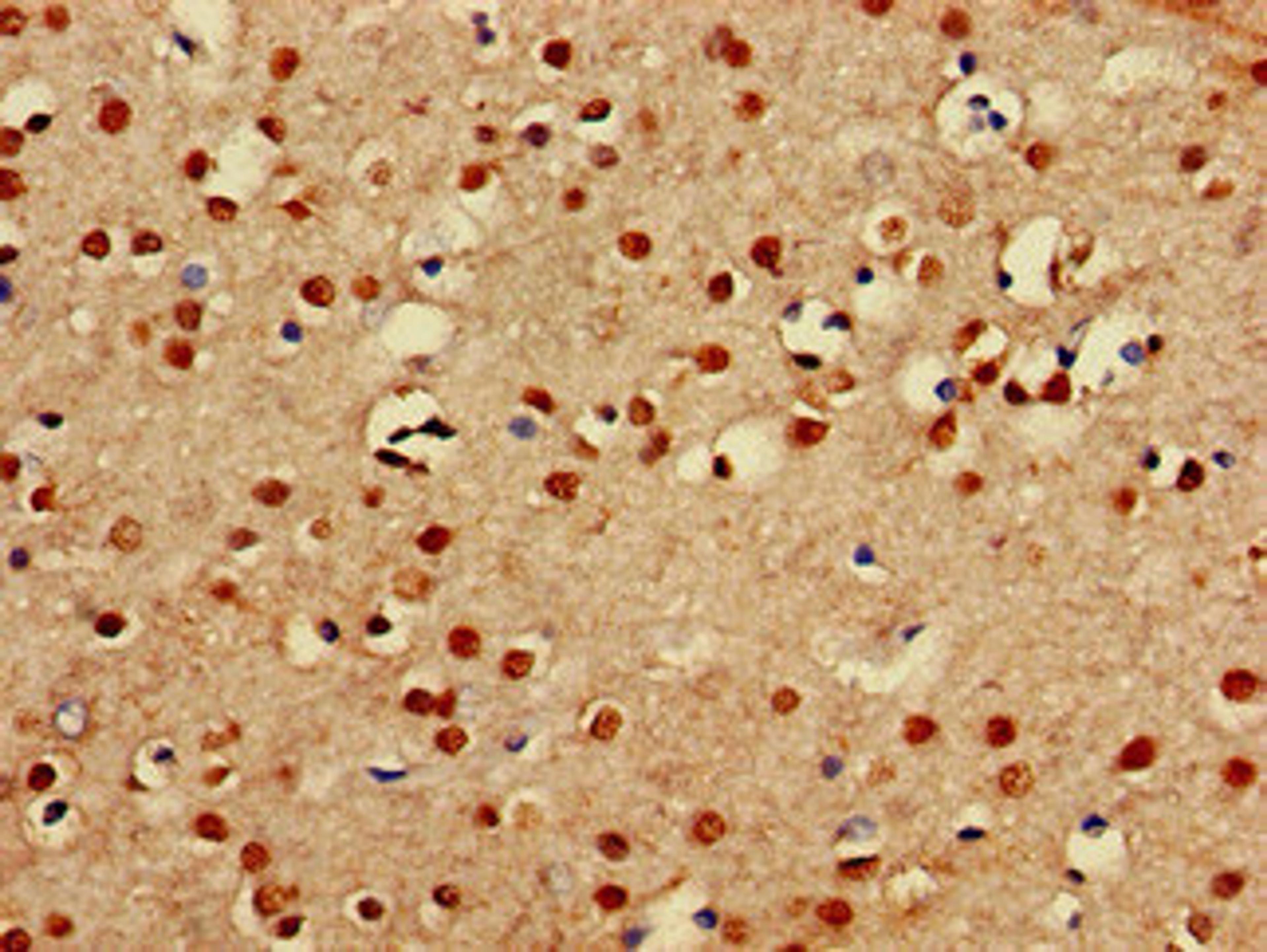 Immunohistochemistry of paraffin-embedded human brain tissue using CSB-PA872534LA01HU at dilution of 1:100