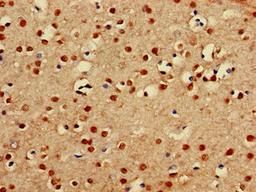 Immunohistochemistry of paraffin-embedded human brain tissue using CSB-PA872534LA01HU at dilution of 1:100