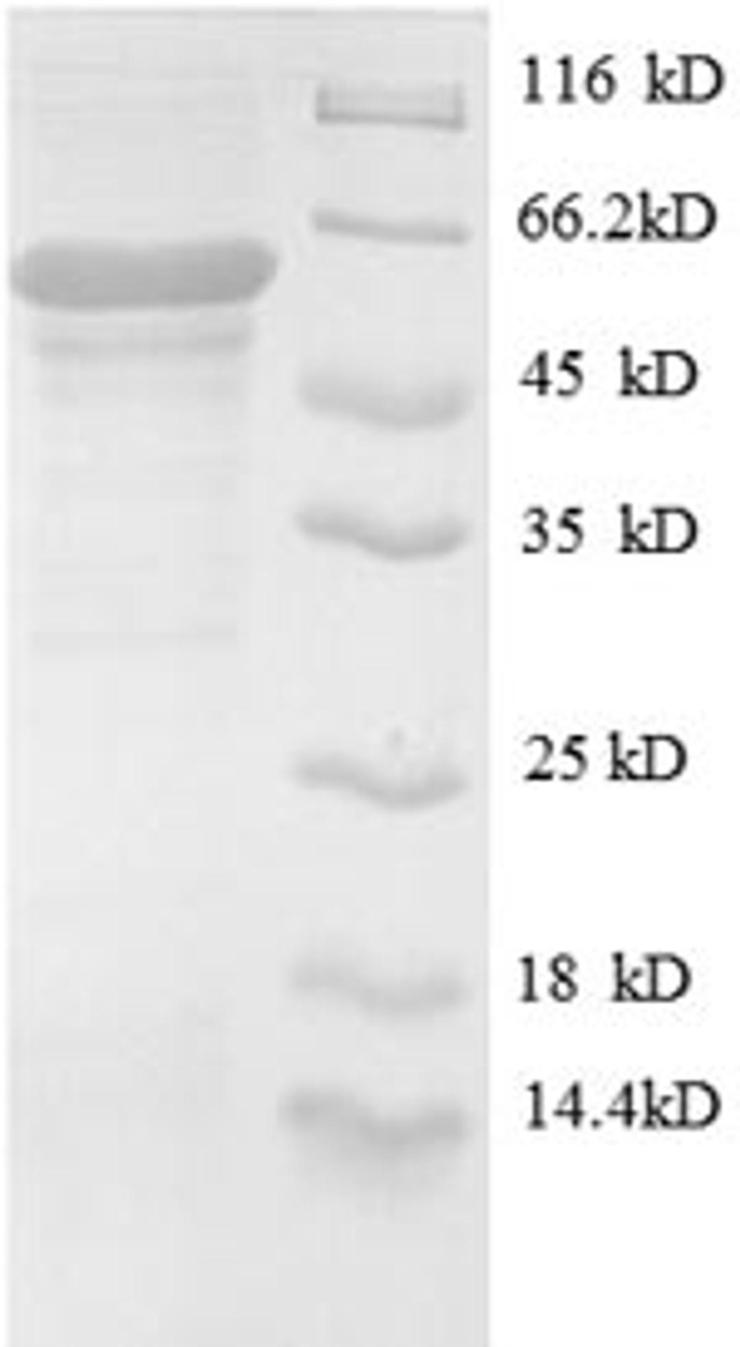 (Tris-Glycine gel) Discontinuous SDS-PAGE (reduced) with 5% enrichment gel and 15% separation gel.