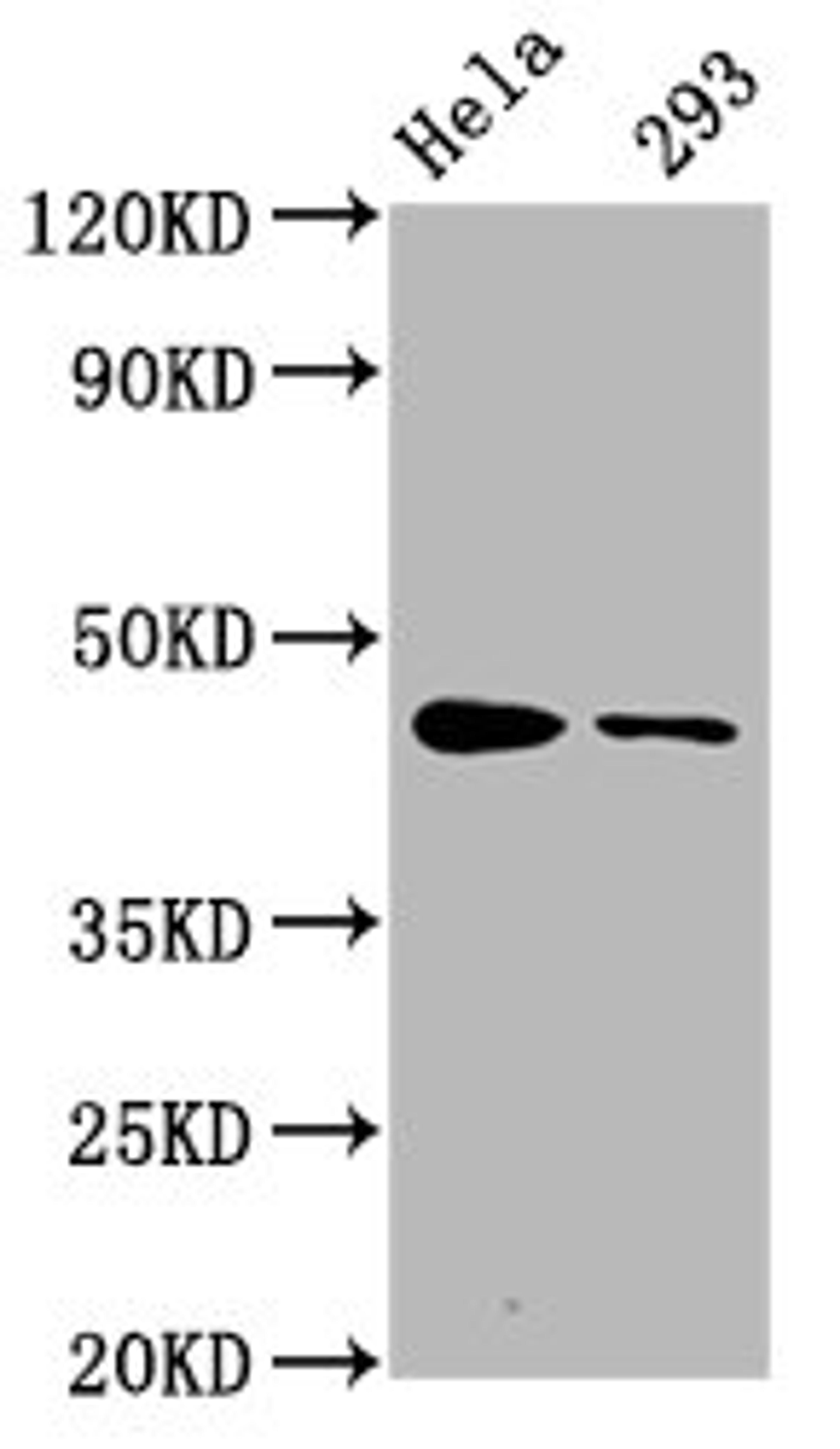 Western Blot. Positive WB detected in Hela whole cell lysate,293 whole cell lysate. All lanes Phospho-CREB1 antibody at 1.65μg/ml. Secondary. Goat polyclonal to rabbit IgG at 1/50000 dilution. Predicted band size: 46 KDa. Observed band size: 46 KDa.