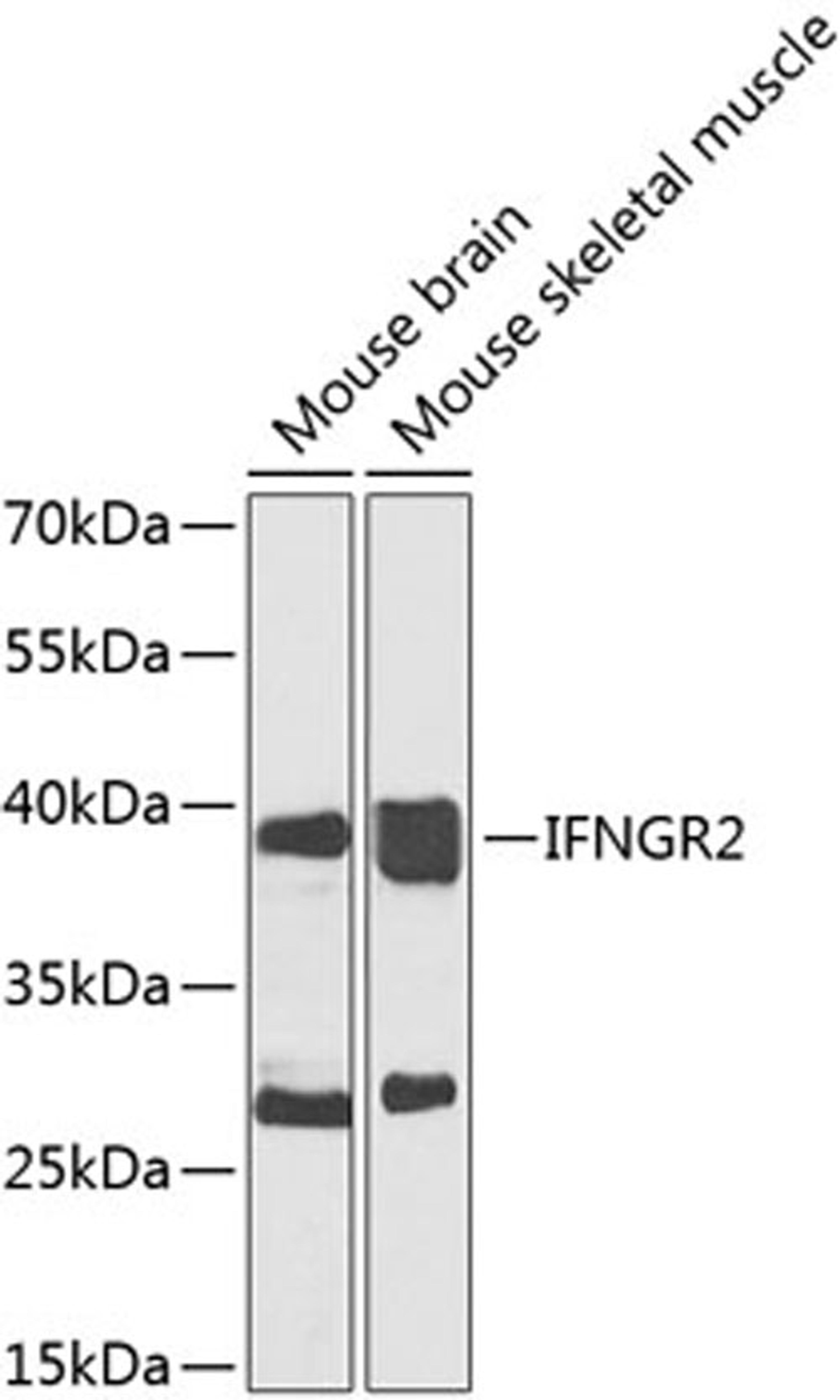 Western blot - IFNGR2 antibody (A7558)