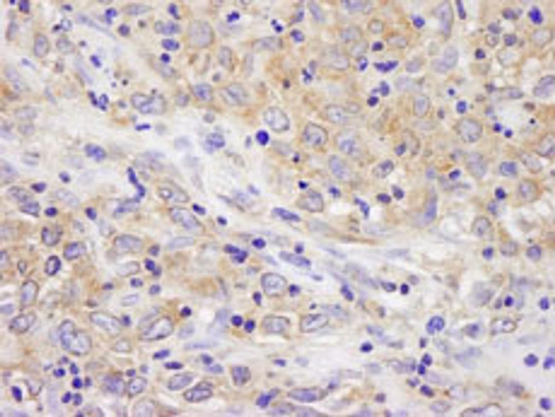 Detection of human BIRC6/Apollon by immunohistochemistry.