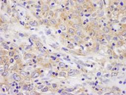 Detection of human BIRC6/Apollon by immunohistochemistry.