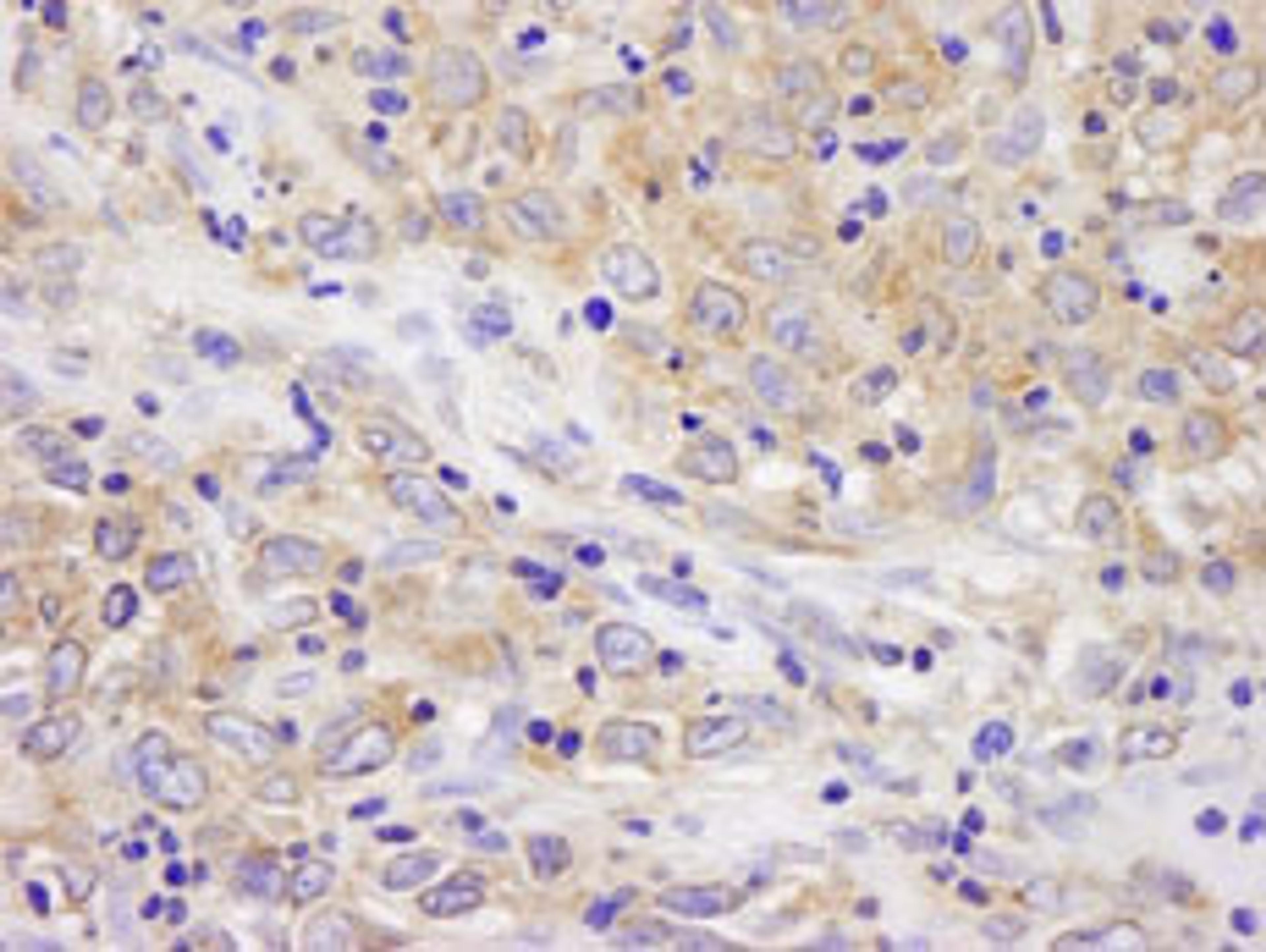 Detection of human BIRC6/Apollon by immunohistochemistry.