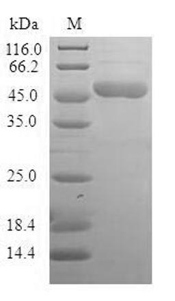 (Tris-Glycine gel) Discontinuous SDS-PAGE (reduced) with 5% enrichment gel and 15% separation gel.