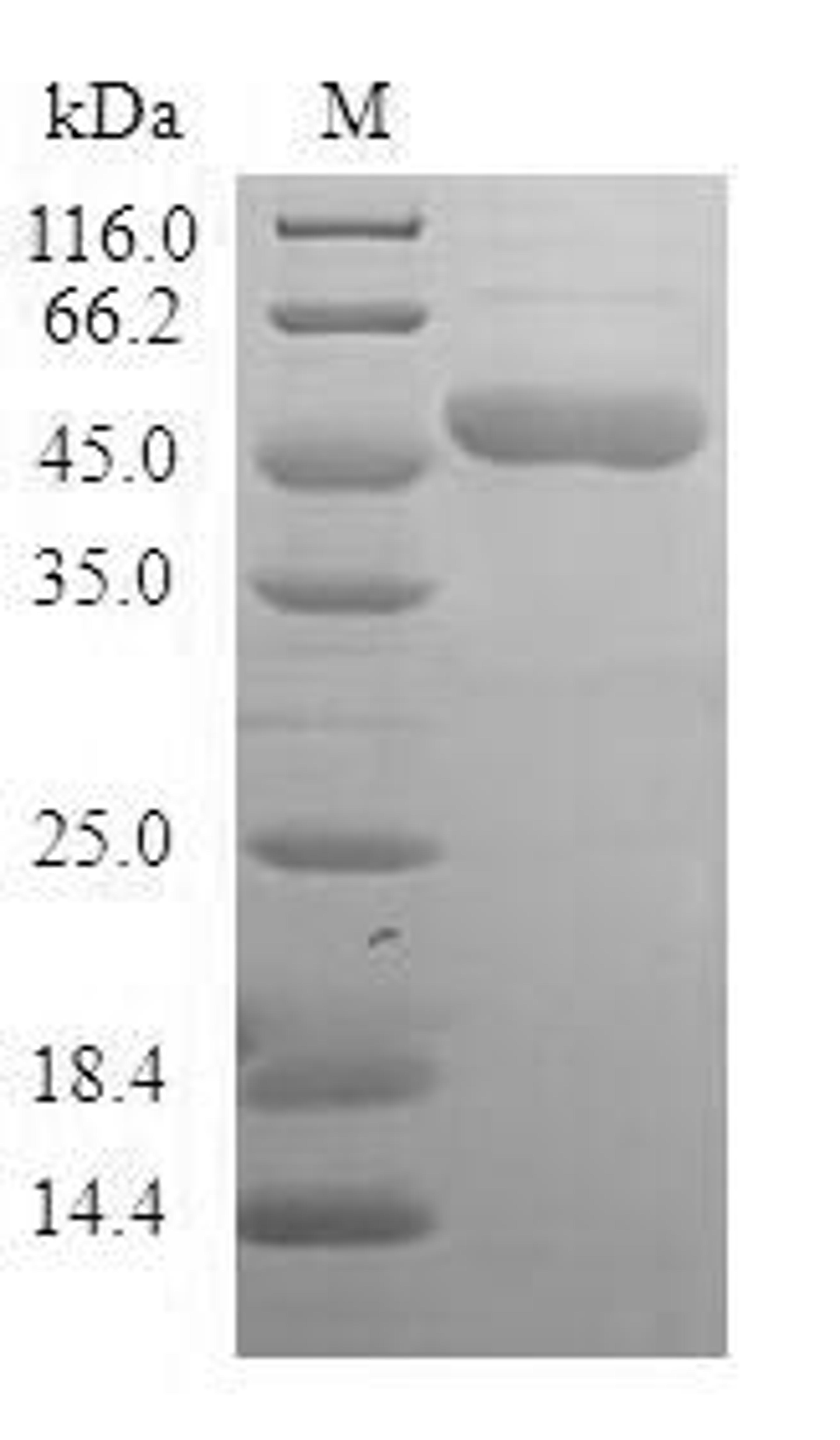 (Tris-Glycine gel) Discontinuous SDS-PAGE (reduced) with 5% enrichment gel and 15% separation gel.