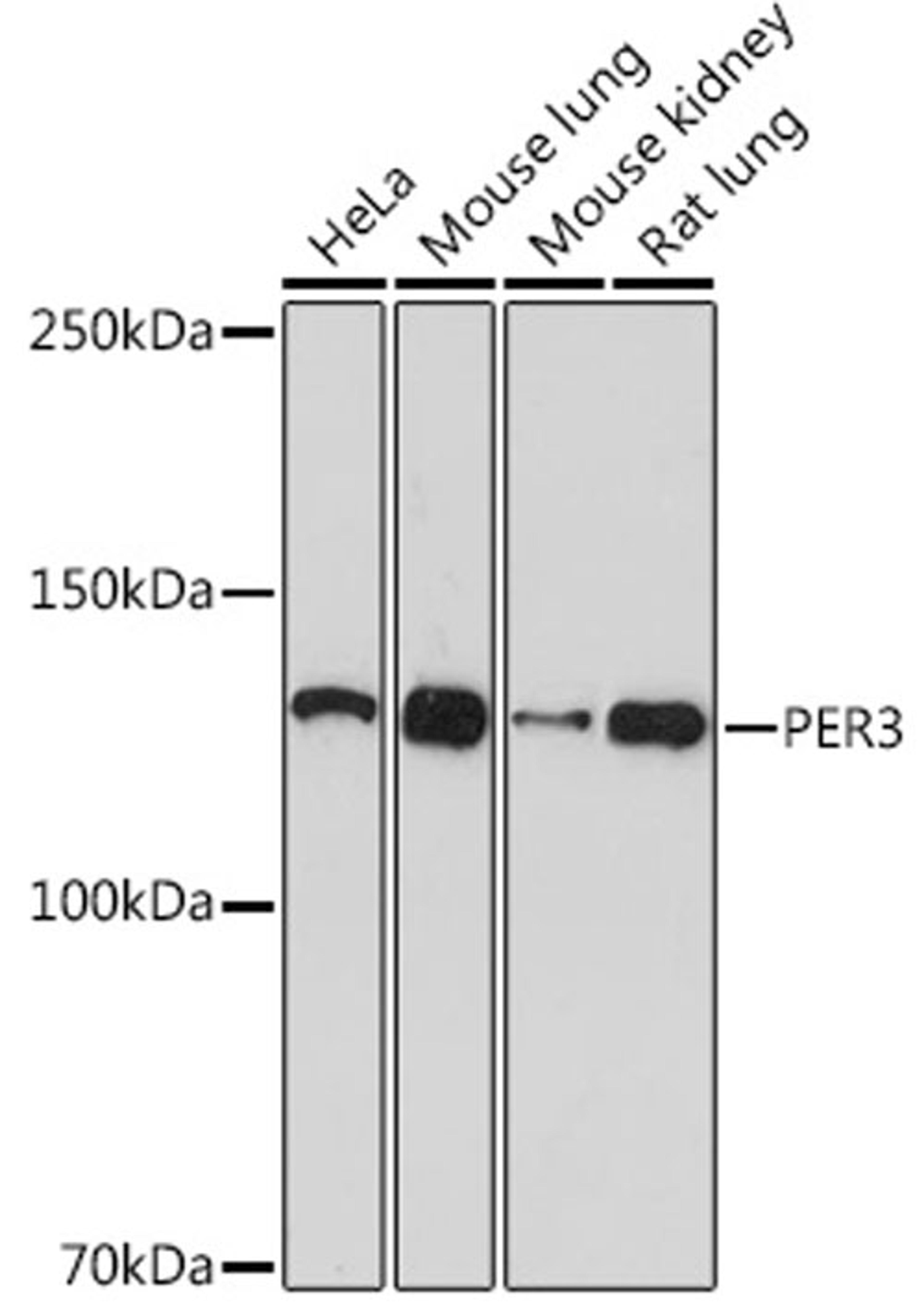 Western blot - PER3 Rabbit mAb (A2219)