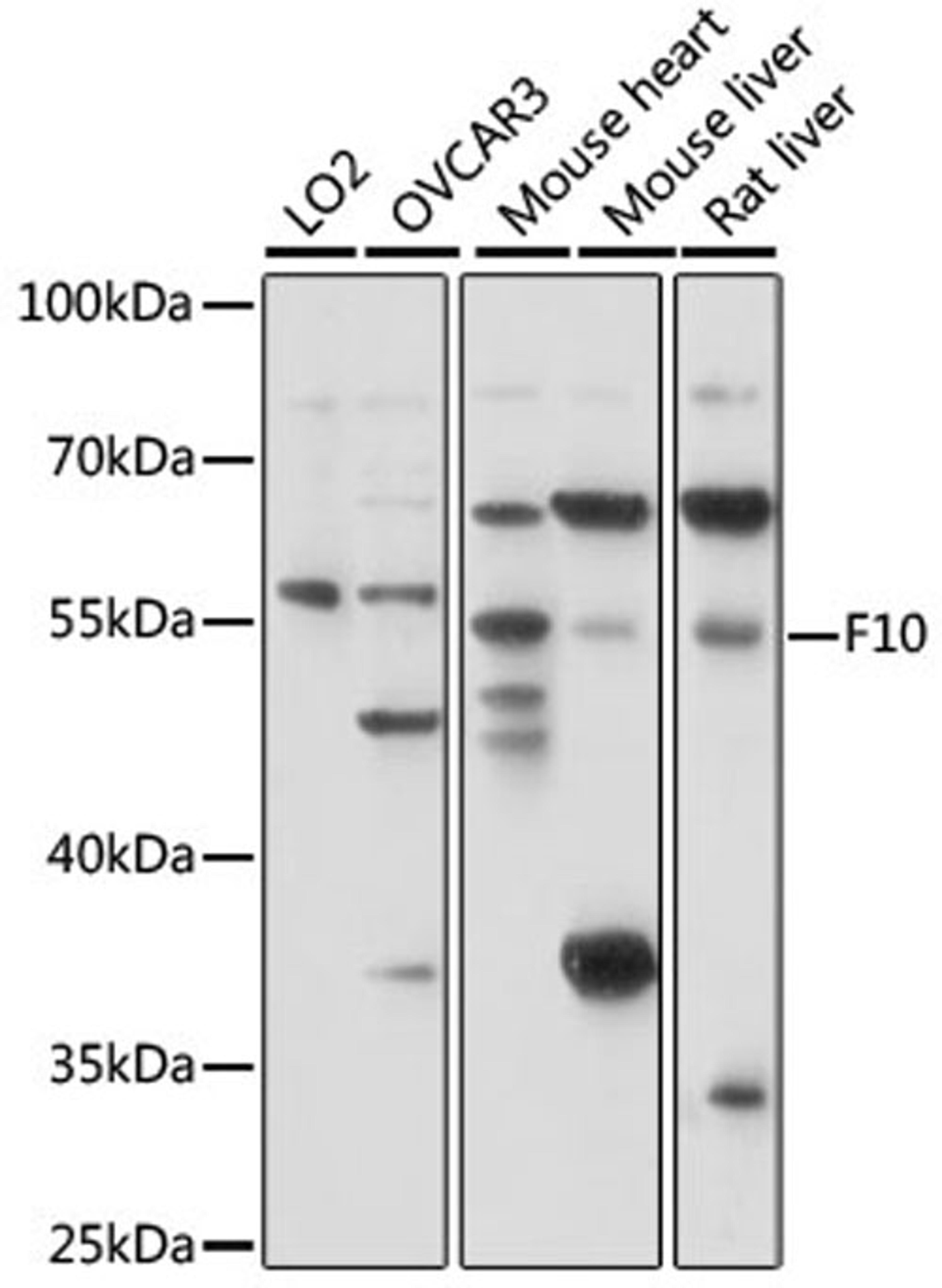 Western blot - F10 antibody (A15057)