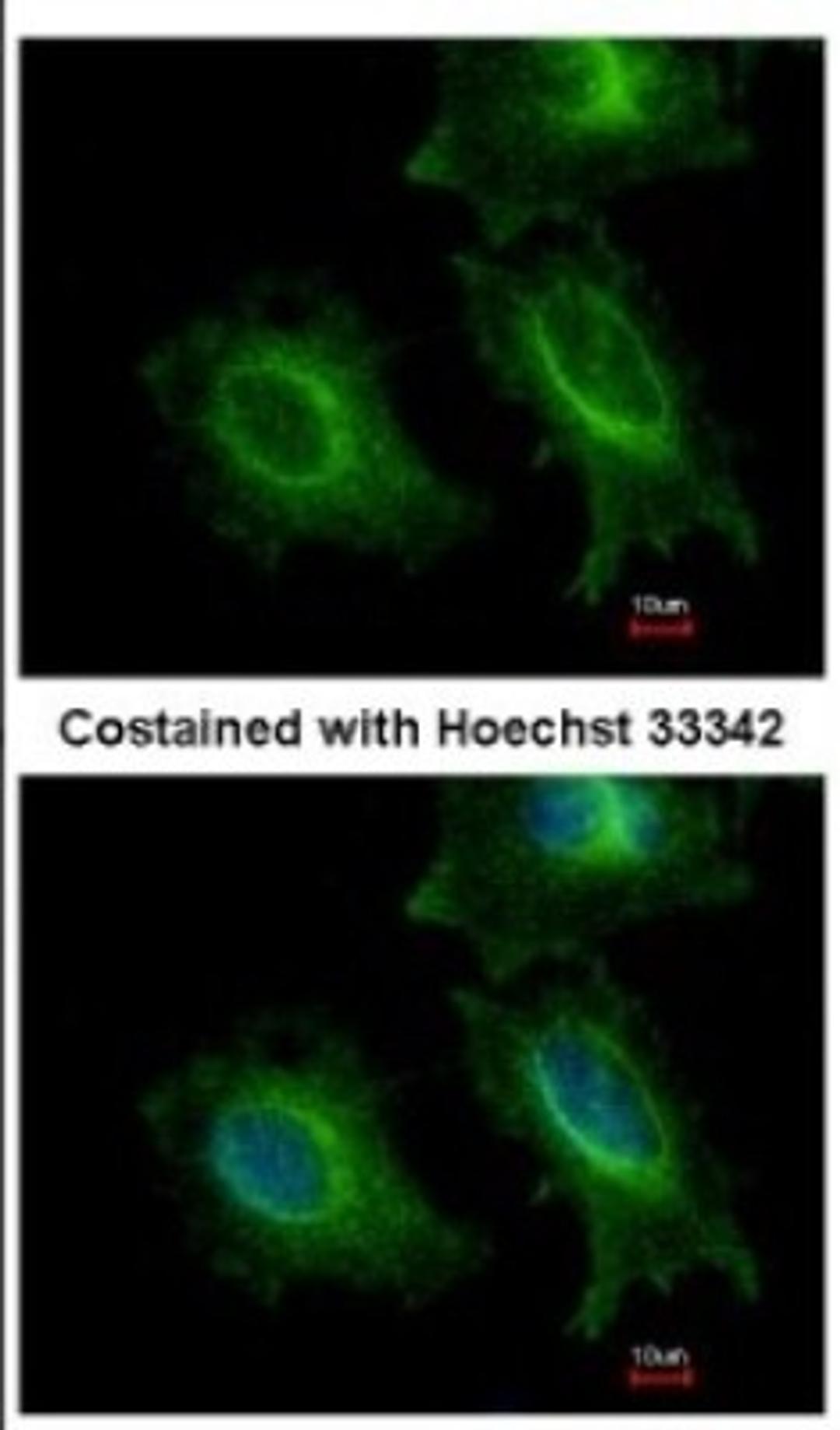 Immunocytochemistry/Immunofluorescence: ITFG1 Antibody [NBP2-16998] - Immunofluorescence analysis of methanol-fixed HeLa, using antibody at 1:500 dilution.