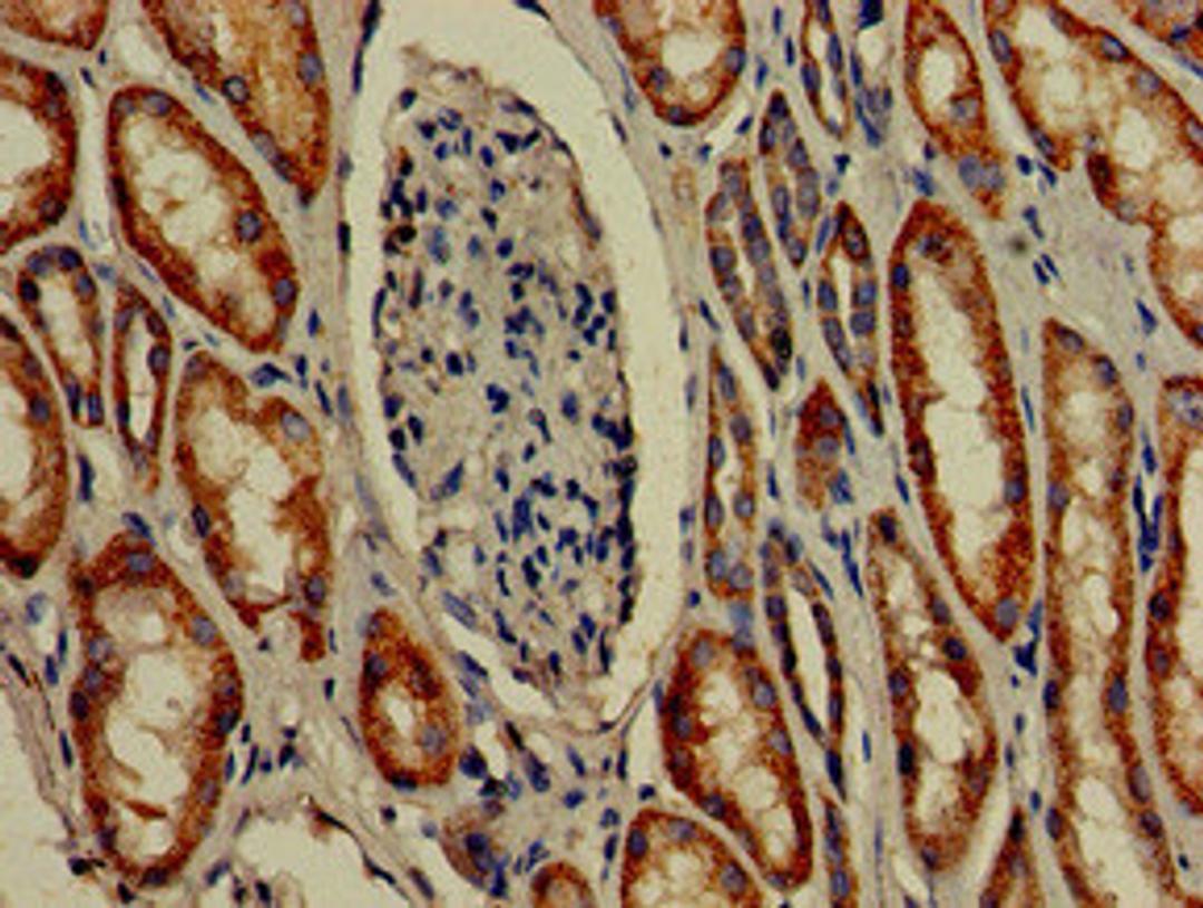 Immunohistochemistry of paraffin-embedded human kidney tissue using CSB-PA850263LA01HU at dilution of 1:100