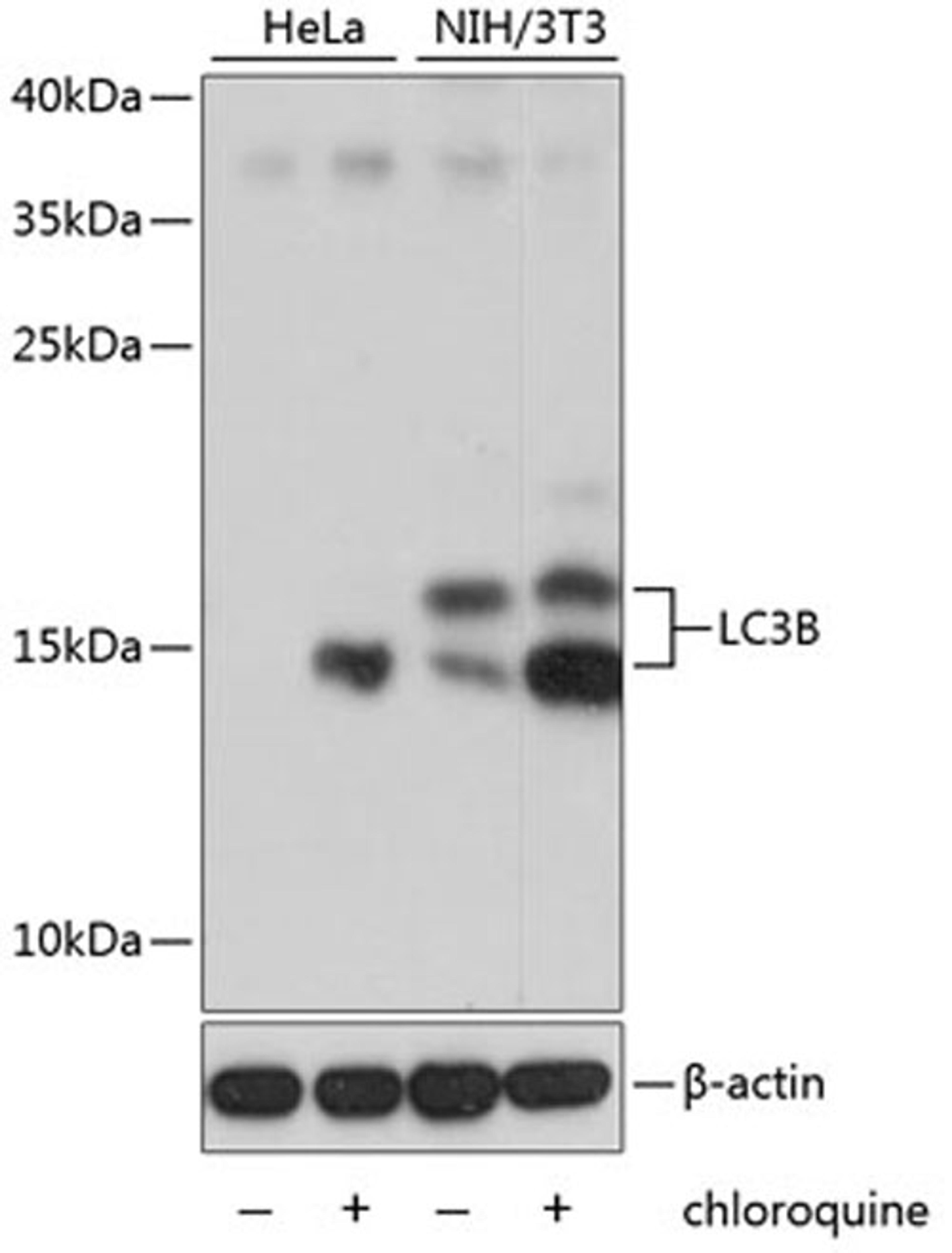 Western blot - LC3B antibody (A11282)