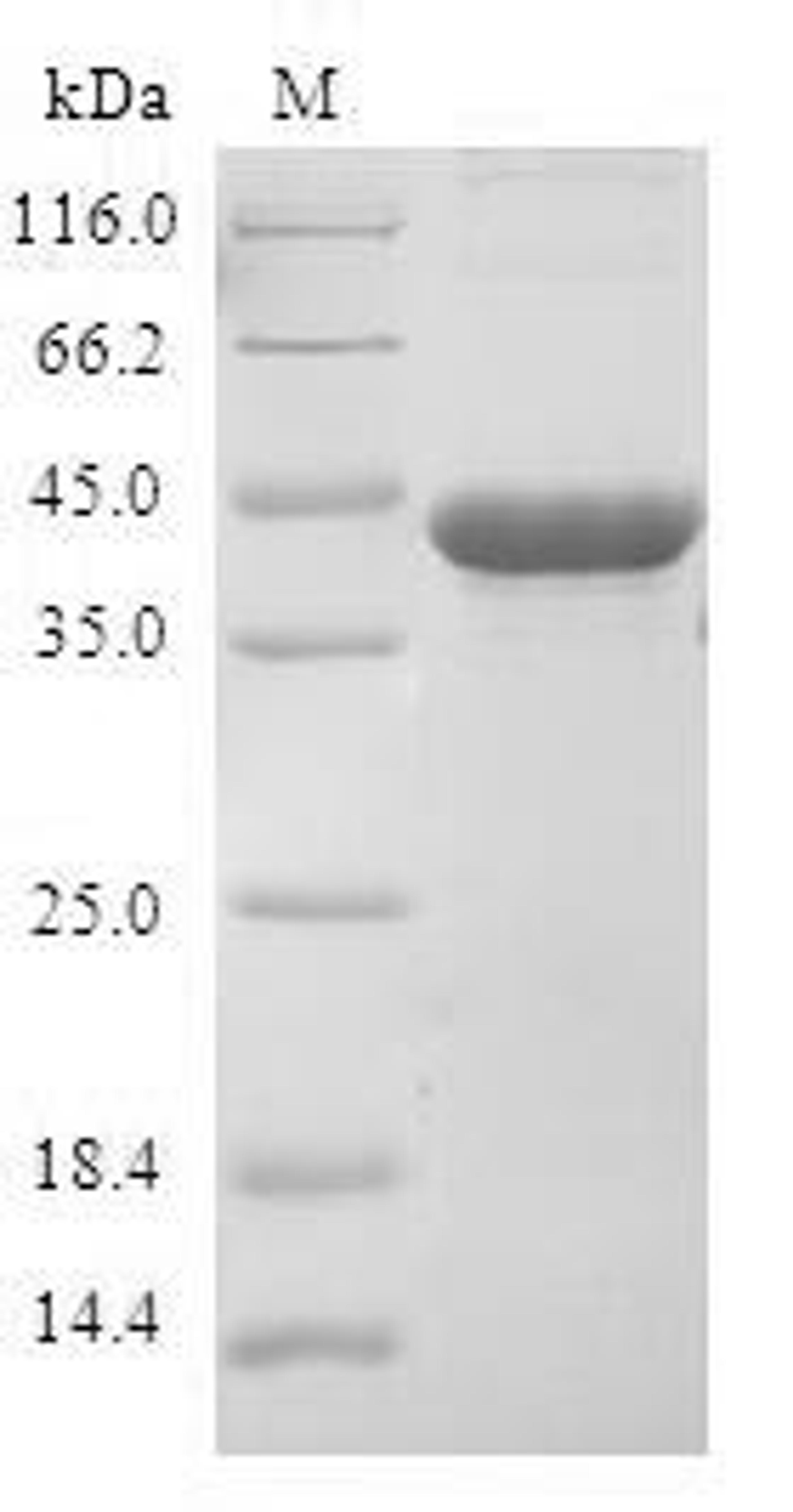 (Tris-Glycine gel) Discontinuous SDS-PAGE (reduced) with 5% enrichment gel and 15% separation gel.