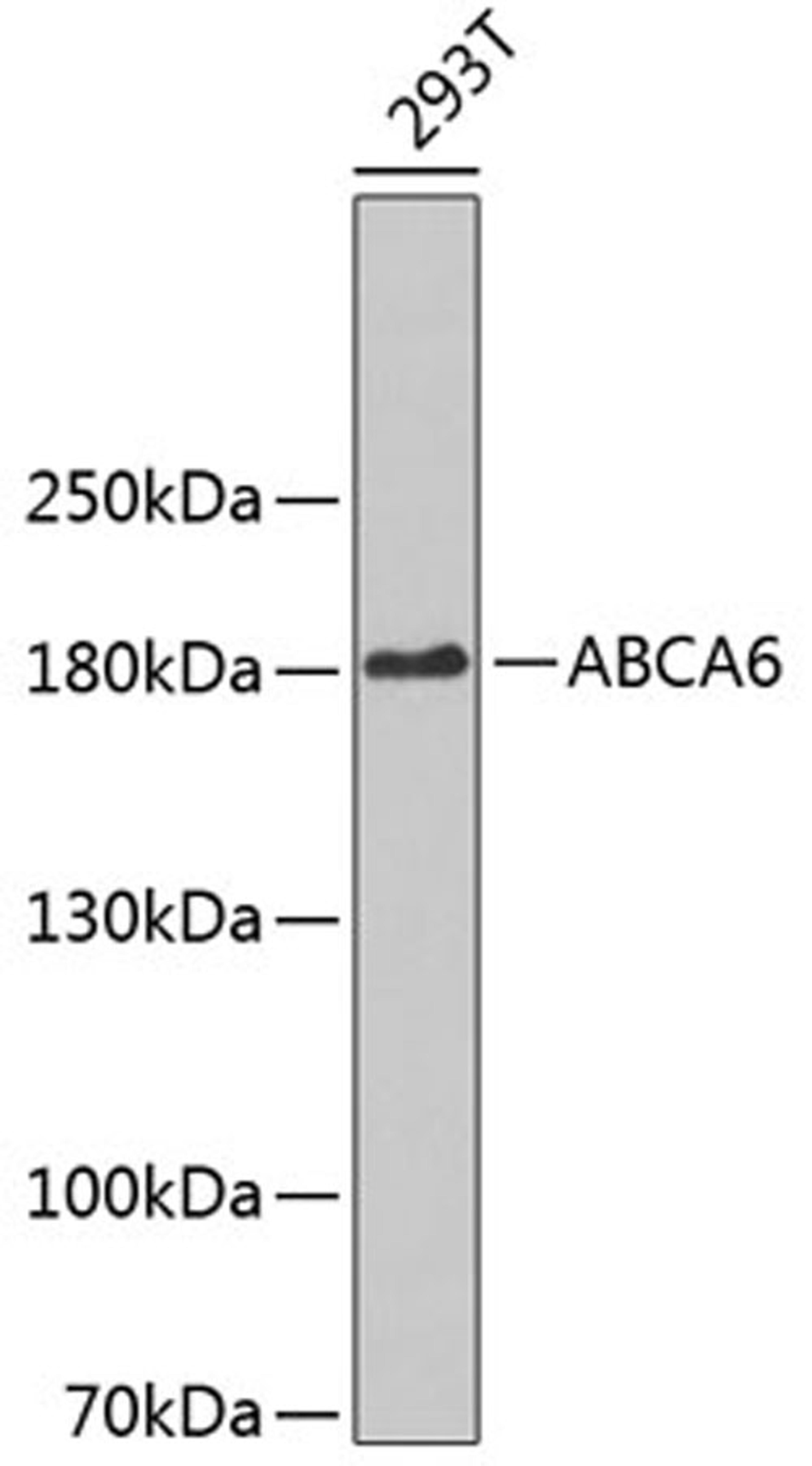 Western blot - ABCA6 antibody (A3191)
