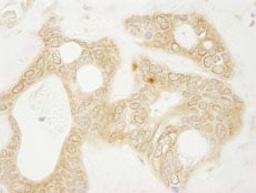 Detection of human vPARP by immunohistochemistry.