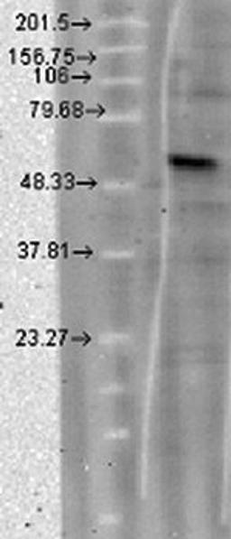 Western blot analysis of T-CHO lysates using CaVbeta4 antibody