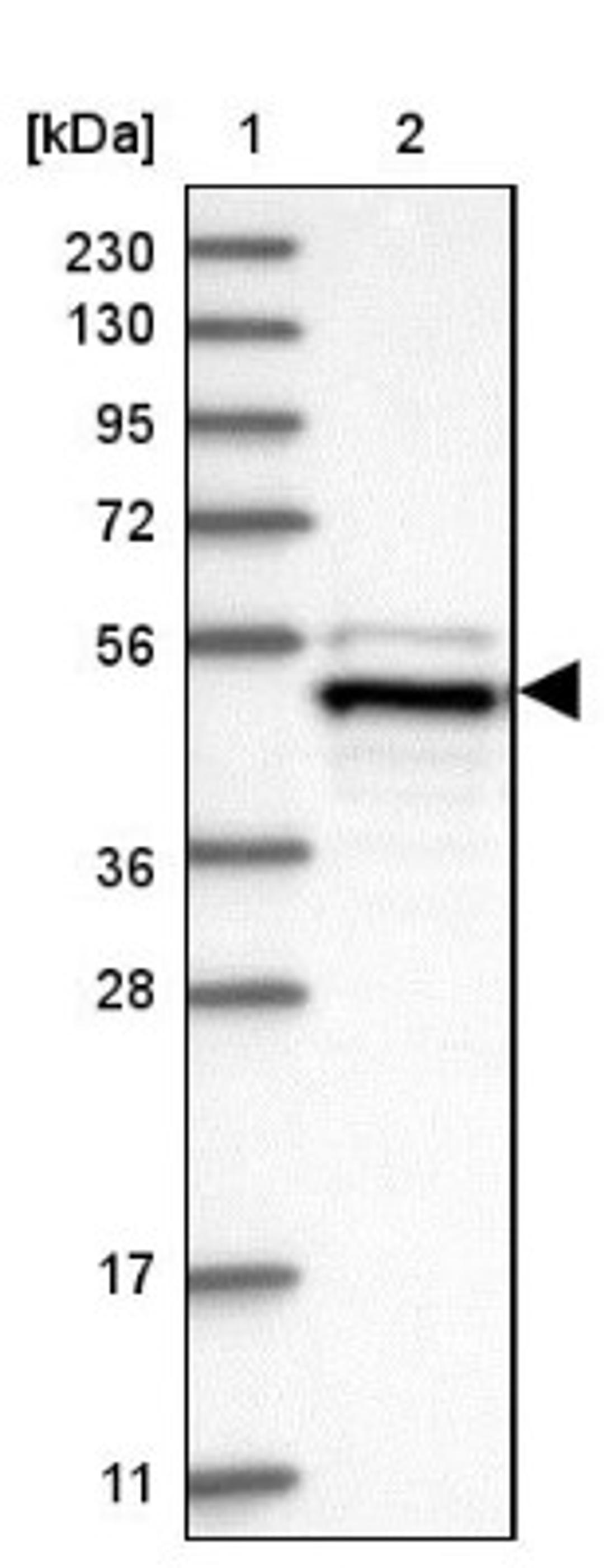 Western Blot: TFAP2B Antibody [NBP1-89063] - Lane 1: Marker [kDa] 230, 130, 95, 72, 56, 36, 28, 17, 11<br/>Lane 2: Human cell line RT-4