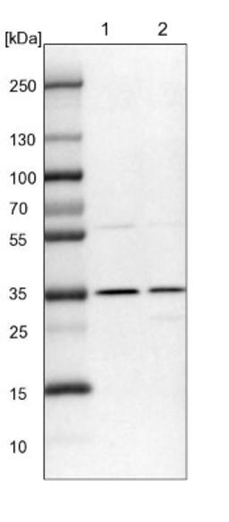 Western Blot: DNAJC17 Antibody [NBP1-84614] - Lane 1: NIH-3T3 cell lysate (Mouse embryonic fibroblast cells)<br/>Lane 2: NBT-II cell lysate (Rat Wistar bladder tumour cells)