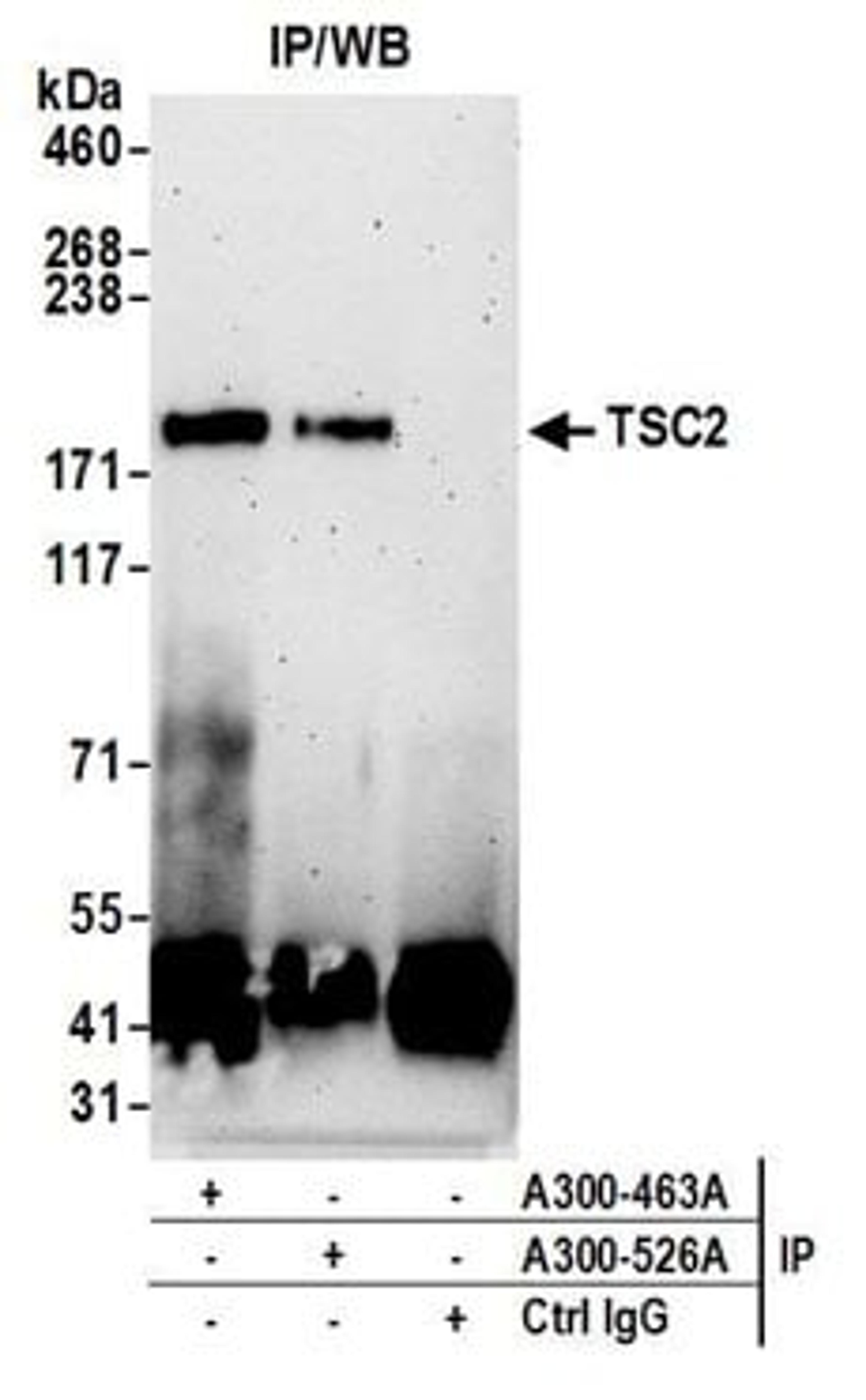 Detection of human TSC2 by western blot of immunoprecipitates.